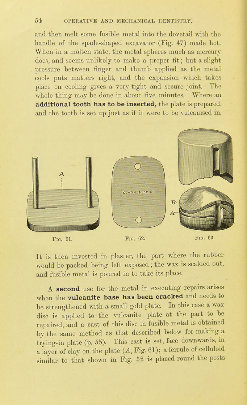 and then melt some fusible metal into the dovetail with the handle of the spade-shaped excavator (Fig. 47) made hot. When in a molten state, the metal spheres much as mercury does, and seems unlikely to make a proper fit; but a slight pressure between finger and thumb applied as the metal cools puts matters right, and the expansion which takes place on cooling gives a very tight and secure joint. The whole thing may be done in about five minutes. Where an additional tooth has to be inserted, the plate is prepared, and the tooth is set up just as if it were to be vulcanised in. Fig. 61. Fig. 62, Fig. 63. It is then invested in plaster, the part where the rubber would be packed being left exposed; the wax is scalded out, and fusible metal is poured in to take its place. A second use for the metal in executing repairs arises when the vulcanite base has been cracked and needs to be strengthened with a small gold plate. In this case a wax disc is applied to the vulcanite plate at the part to be repaired, and a cast of this disc in fusible metal is obtained by the same method as that described below for making a trying-in plate (p. 55). This cast is set, face downwards, in a layer of clay on the plate (A, Fig. 61); a ferrule of celluloid similar to that shown in Fig. 52 is placed round the posts