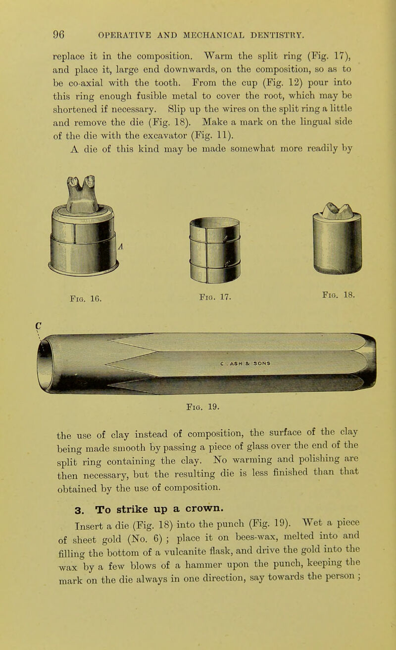 replace it in the composition. Warm the split ring (Fig. 17), and place it, large end downwards, on the composition, so as to be co-axial with the tooth. From the cup (Fig. 12) pour into this ring enough fusible metal to cover the root, which may be shortened if necessary. Slip up the wires on the split ring a little and remove the die (Fig. 18). Make a mark on the lingual side of the die with the excavator (Fig. 11). A die of this kind may be made somewhat more readily by Fig. 19. the use of clay instead of composition, the surface of the clay being made smooth by passing a piece of glass over the end of the split ring containing the clay. No warming and polishing are then necessary, but the resulting die is less finished than that obtained by the use of composition. 3. To strike up a crown. Insert a die (Fig. 18) into the punch (Fig. 19). Wet a piece of sheet gold (No. 6) ; place it on bees-wax, melted into and filling the bottom of a vulcanite flask, and drive the gold into the wax by a few blows of a hammer upon the punch, keeping the mark on the die always in one direction, say towards the person ;