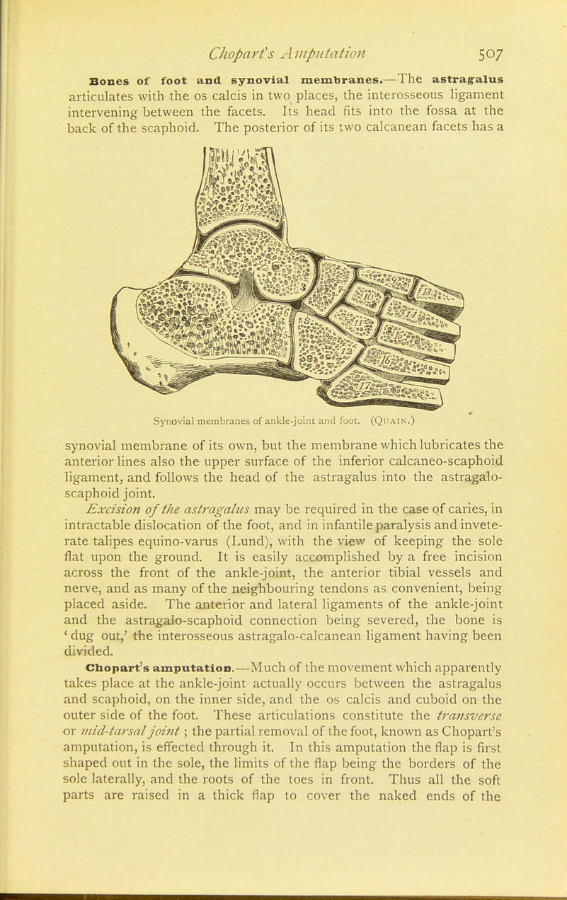 Bones of foot and synovial membranes.—The astragalus .articulates with the os calcis in two places, the interosseous ligament intervening between the facets. Its head fits into the fossa at the back of the scaphoid. The posterior of its two calcanean facets has a Synovial membranes of ankle-joint and foot. (Quain.) synovial membrane of its own, but the membrane which lubricates the anterior lines also the upper surface of the inferior calcaneo-scaphoid ligament, and follows the head of the astragalus into the astragalo- scaphoid joint. Excision of the astragalus may be required in the case of caries, in intractable dislocation of the foot, and in infantile paralysis and invete- rate talipes equino-varus (Lund), with the view of keeping the sole flat upon the ground. It is easily accomplished by a free incision across the front of the ankle-joint, the anterior tibial vessels and nerve, and as many of the neighbouring tendons as convenient, being placed aside. The anterior and lateral ligaments of the ankle-joint and the astragalo-scaphoid connection being severed, the bone is ' dug out,' the interosseous astragalo-calcanean ligament having been divided. choparts amputation.—Much of the movement which apparently takes place at the ankle-joint actually occurs between the astragalus and scaphoid, on the inner side, and the os calcis and cuboid on the outer side of the foot. These articulations constitute the transverse or mid-tarsal joint; the partial removal of the foot, known as Chopart's amputation, is effected through it. In this amputation the flap is first shaped out in the sole, the limits of the flap being the borders of the sole laterally, and the roots of the toes in front. Thus all the soft parts are raised in a thick flap to cover the naked ends of the