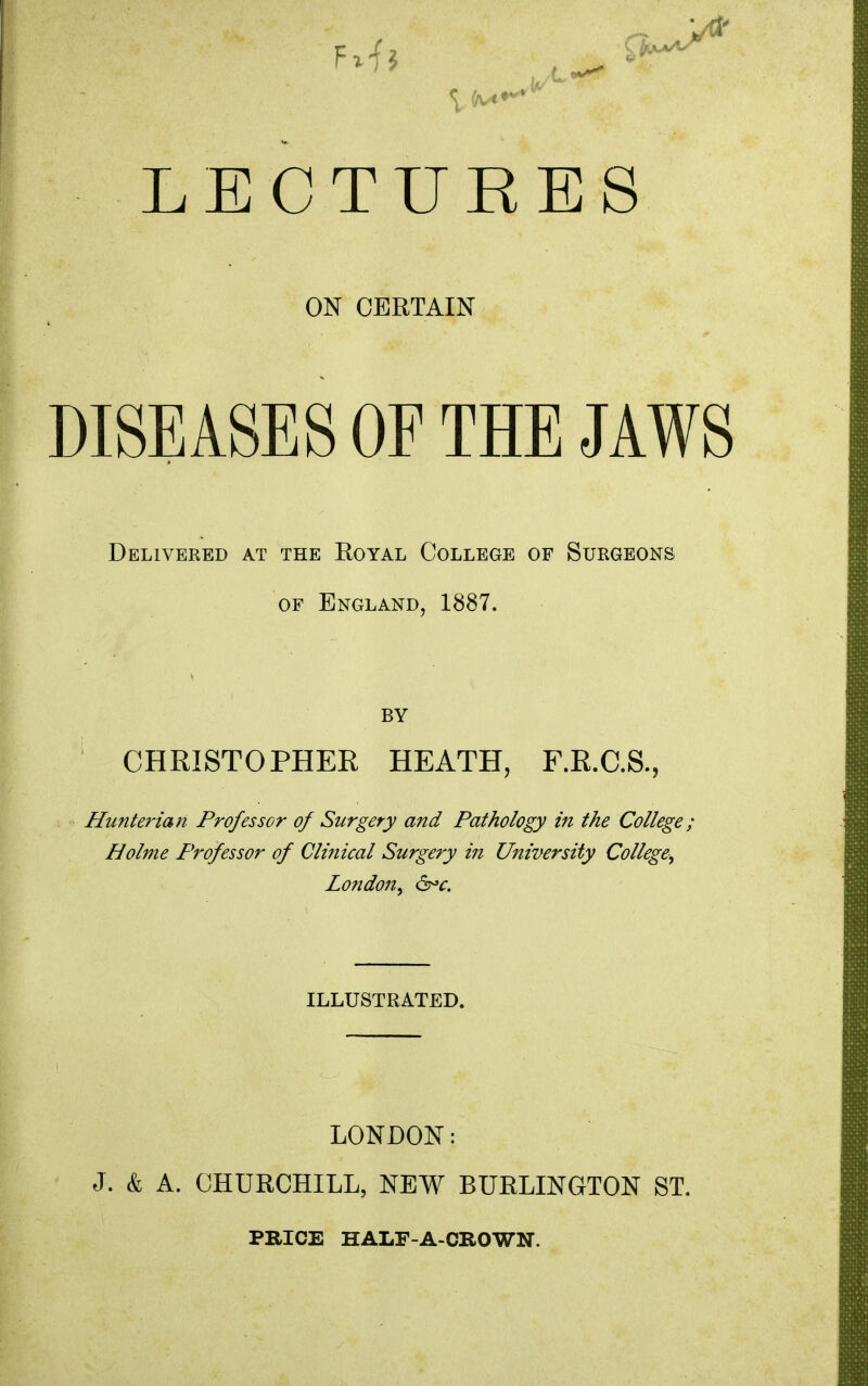 ON CERTAIN DISEASES OE THE JAWS Delivered at the Royal College of Surgeons OF England, 1887. BY CHRISTOPHER HEATH, F.R.C.S., Hunterian Professor of Surgery and Pathology in the College_ Holme Professor of Clinical Surgery in University College, London, &>c. ILLUSTRATED. LONDON: J. & A. CHURCHILL, NEW BURLINGTON ST.