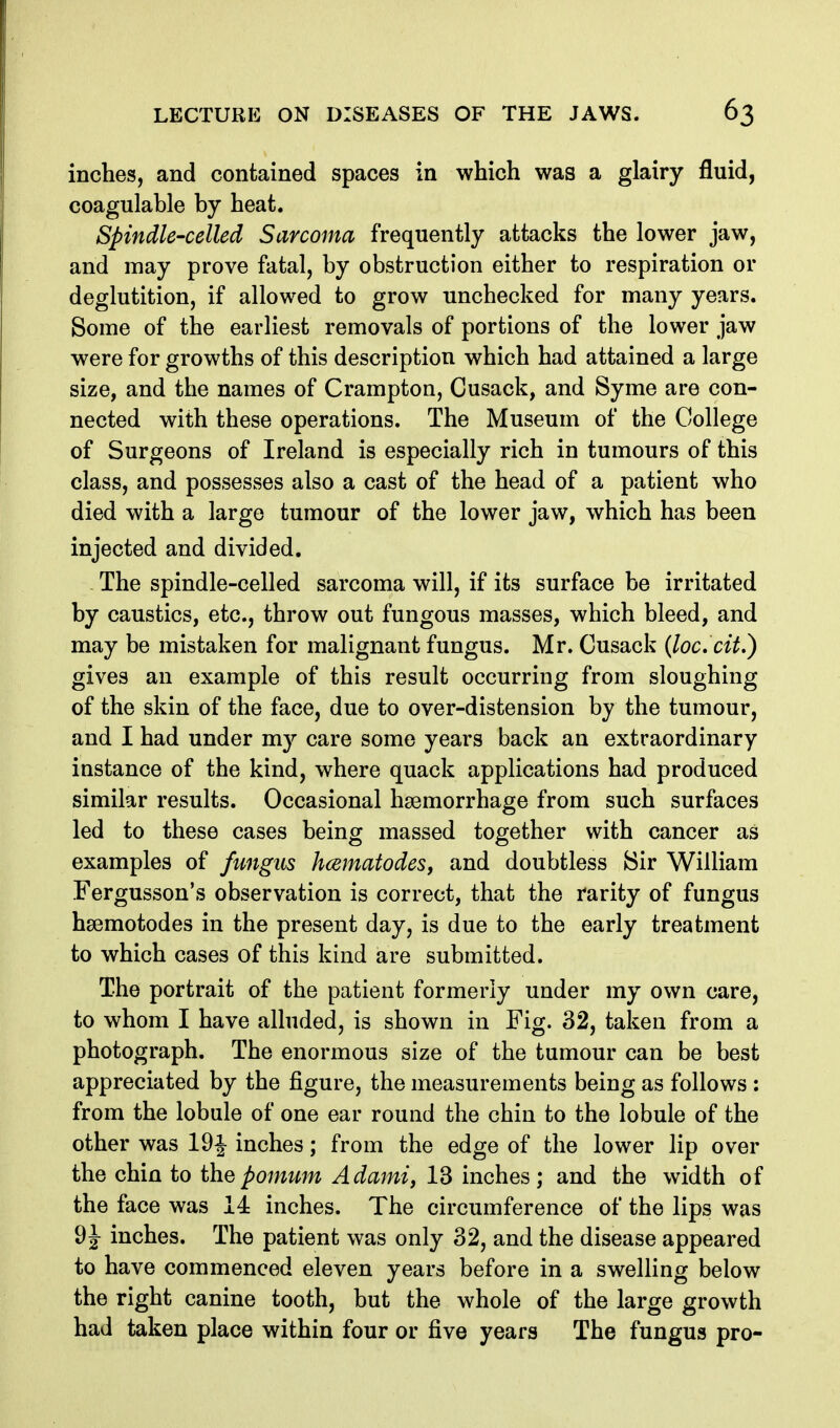 inches, and contained spaces in which was a glairy fluid, coagulable by heat. Spindle-celled Sarcoma frequently attacks the lower jaw, and may prove fatal, by obstruction either to respiration or deglutition, if allowed to grow unchecked for many years. Some of the earliest removals of portions of the lower jaw were for growths of this description which had attained a large size, and the names of Crampton, Cusack, and Syme are con- nected with these operations. The Museum of the College of Surgeons of Ireland is especially rich in tumours of this class, and possesses also a cast of the head of a patient who died with a large tumour of the lower jaw, which has been injected and divided. The spindle-celled sarcoma will, if its surface be irritated by caustics, etc., throw out fungous masses, which bleed, and may be mistaken for malignant fungus. Mr. Cusack {loc. cit.) gives an example of this result occurring from sloughing of the skin of the face, due to over-distension by the tumour, and I had under my care some years back an extraordinary instance of the kind, where quack applications had produced similar results. Occasional hsemorrhage from such surfaces led to these cases being massed together with cancer as examples of fungus hcematodes, and doubtless Sir William Fergusson's observation is correct, that the rarity of fungus hsemotodes in the present day, is due to the early treatment to which cases of this kind are submitted. The portrait of the patient formerly under my own care, to whom I have alluded, is shown in Fig. 32, taken from a photograph. The enormous size of the tumour can be best appreciated by the figure, the measurements being as follows : from the lobule of one ear round the chin to the lobule of the other was 19J inches; from the edge of the lower lip over the chin to the pomum Adami, 13 inches ; and the width of the face was 14 inches. The circumference of the lips was 9|- inches. The patient was only 32, and the disease appeared to have commenced eleven years before in a swelling below the right canine tooth, but the whole of the large growth had taken place within four or five years The fungus pro-