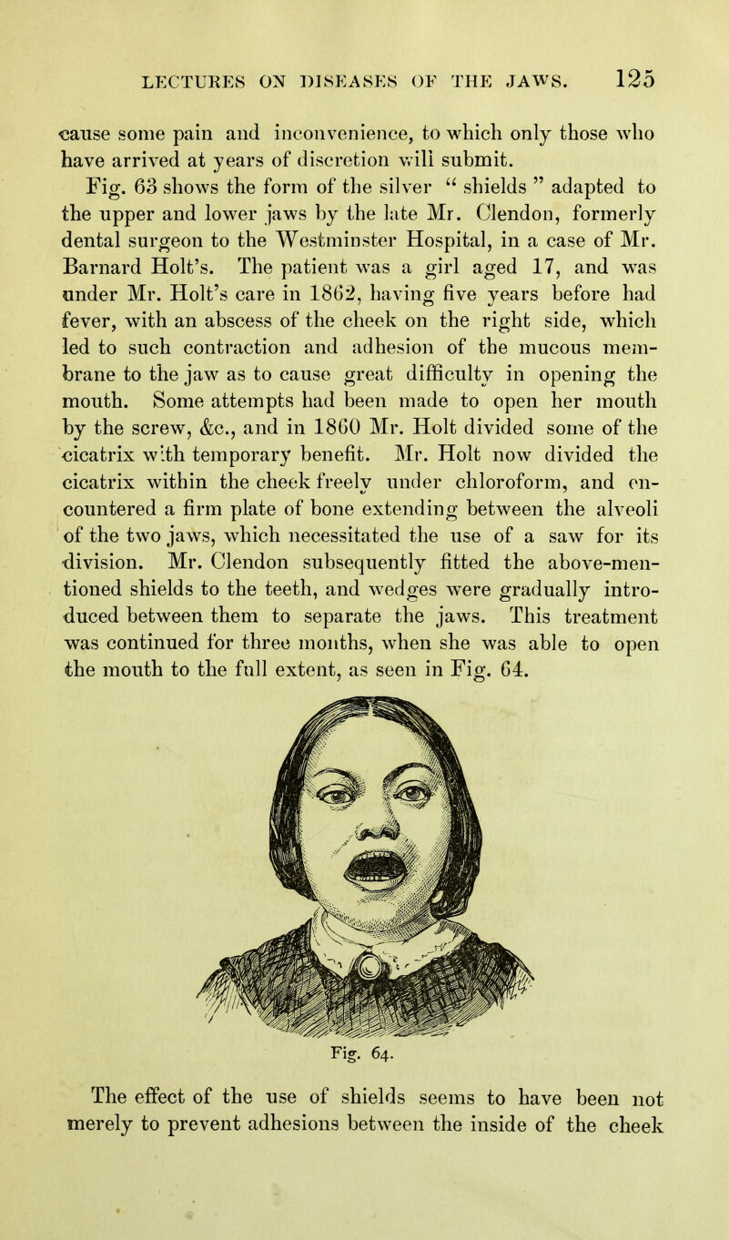 cause some pain and inconvenience, to which only those who have arrived at years of discretion v»'ili submit. Fig. 63 shows the form of the silver shields adapted to the upper and lower jaws by the late Mr. Clendon, formerly dental surgeon to the Westminster Hospital, in a case of Mr. Barnard Holt's. The patient was a girl aged 17, and was under Mr. Holt's care in 1862, having five years before had fever, with an abscess of the cheek on the right side, which led to such contraction and adhesion of the mucous mem- brane to the jaw as to cause great difficulty in opening the mouth. Some attempts had been made to open her mouth by the screw, &c., and in 1860 Mr. Holt divided some of the cicatrix with temporary benefit. Mr. Holt now divided the cicatrix within the cheek freely under chloroform, and en- countered a firm plate of bone extending between the alveoli of the two jaws, which necessitated the use of a saw for its -division. Mr. Clendon subsequently fitted the above-men- tioned shields to the teeth, and wedges were gradually intro- duced between them to separate the jaws. This treatment was continued for three months, when she was able to open the mouth to the full extent, as seen in Fig. 64. Fig. 64. The effect of the use of shields seems to have been not merely to prevent adhesions between the inside of the cheek