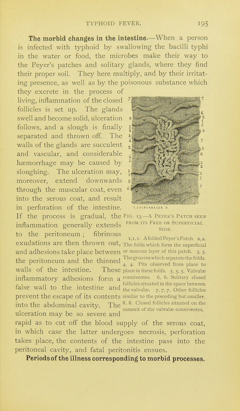 The morbid changes in the intestine.—When a person is infected with typhoid by swallowing the bacilli typhi in the water or food, the microbes make their way to the Peyer's patches and solitary glands, where they find their proper soil. They here multiply, and by their irritat- ing presence, as well as by the poisonous substance which they excrete in the process of living, inflammation of the closed follicles is set up. The glands swell and become solid, ulceration follows, and a slough is finally separated and thrown off. The walls of the glands are succulent and vascular, and considerable haemorrhage may be caused by sloughing. The ulceration may, moreover, extend downwards through the muscular coat, even into the serous coat, and result .  in perforation of the intestine. ? t If the process is gradual, the Fig. 13.—a peyer's Patch seen FROM ITS Free or Superficial to the peritoneum ; fibrinous inflammation generally extends ^ Side . A folded Peyei-'s Patch. 2,2. exudations are then thrown out, The folds which form the superficial and adhesions take place between °^ mucous layer of this patch. 3,3. ,1 J i-1 • J The grooves which separate the folds. the peritoneum and the thinned , J. , 4, 4. Pits observed from place to walls of the intestine. These place in these folds. 5, 5, 5. Valvulse inflammatory adhesions form a conniventes. 6, 6. Sohtary closed J- , ,, , . . folhcles situated in the space between false wall to the intestme and thevaivuice. 7,7,7. other follicles prevent the escape of its contents similar to the preceding but smaller. into the abdominal cavity. The ^' ^- ^^''^ ''^'^''^'^ ° '^'^ . summit of the valvulas conniventes. ulceration may be so severe and rapid as to cut off the blood supply of the serous coat, in which case the latter undergoes necrosis, perforation takes place, the contents of the intestine pass into the peritoneal cavity, and fatal peritonitis ensues. Periods of the illness corresponding to morbid processes.