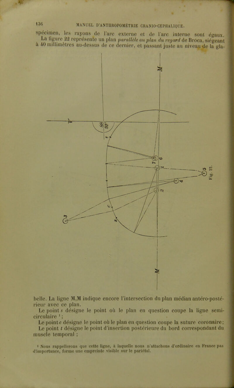 spécimen, les rayons de l'are externe et de lare interne sont égaux. La ligure 22 représente un plan parallèle au plan du regard de Broca, siégeant à 40 millimètres au-dessus de ce dernier, et passant juste au niveau de la gla- 1^ belle. La ligne M,M indique encore l'intersection du plan médian antéro-posté- rieur avec ce plan. Le point s désigne le point où le plan en question coupe la ligne semi- circulaire ' ; Le pointe désigne le point où le plan en question coupe la suture coronaire; Le point / désigne le point d'insertion postérieure du bord correspondant du muscle temporal ; 1 Nous rappellerons que celte ligne, à laquelle nous n'attachons d'ordinaire en France pas d'importance, forme une empreinte visible sur le pariétal.