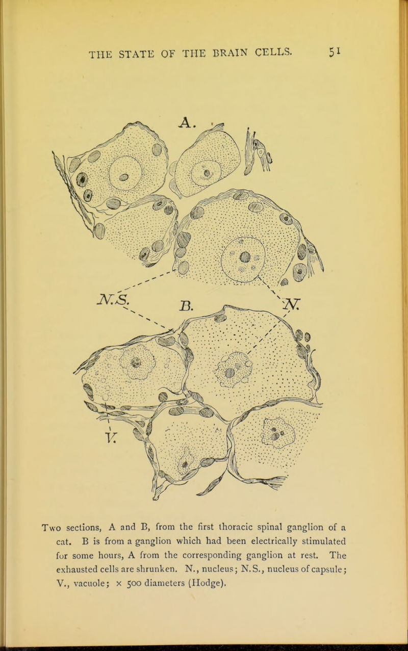wo sections, A and B, from the first thoracic spinal ganglion of a cat. B is from a ganglion which had been electrically stimulated for some hours, A from the corresponding ganglion at rest. The exhausted cells are shrunken. N., nucleus; N.S., nucleus of capsule; v., vacuole; x 500 diameters (Hodge).
