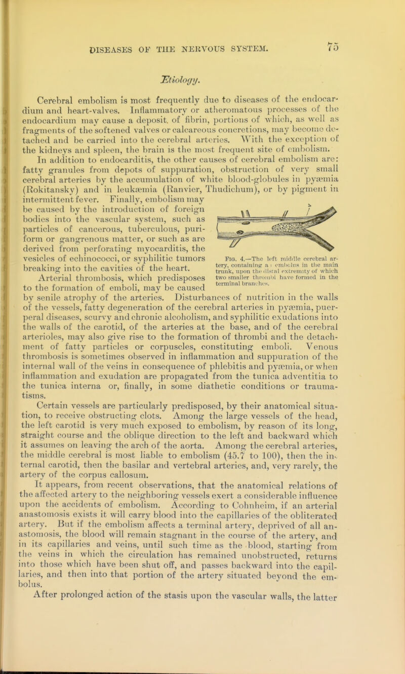 ^Etiology. Cerebral embolism is most frequently due to diseases of the endocar- dium and heart-valves. Inflammatory or atheromatous processes of the endocardium may cause a deposit, of fibrin, portions of Avliich, as well as fragments of the softened valves or calcareous concretions, may become de- tached and be carried into the cerebral arteries. Witii the exception of the kidneys and spleen, the brain is the most frequent site of embolism. In addition to endocarditis, the other causes of cerebral embolism are: fatty granules from depots of suppuration, obstruction of very small cerebral arteries by the accumulation of white blood-globules in pyn'mia (Rokitansky) and in leuki^^mia (Ranvier, Thudichum), or by pigment in intermittent fever. Finally, embolism may be caused by the introduction of foreign bodies into the vascular system, such as particles of cancerous, tuberculous, puri- form or gangrenous matter, or such as are derived from perforating myocarditis, the vesicles of echinOCOCci, or syphilitic tumors Fig. 4.—The left miciaie cerebral ar- breaking into the cavities of the heart. ^^K^th^.n-re^tl^ll'^yo^ Arterial thrombosis, which predisposes two smaller thn.iiilii have formed in the ,1,. p 11- 1 1 terminal branches. to the lormation oi emboli, niay be caused by senile atrophy of the arteries. Disturbances of nutrition in the walls of the vessels, fatty degeneration of the cerebral arteries in pyasmia, puer- peral diseases, scurvy and chronic alcoholism, and syphilitic exudations into the walls of the carotid, of the arteries at the base, and of the cerebral arteriole-s, may also give rise to the formation of thrombi and the detach- ment of fatty particles or corpuscles, constituting emboli. Venous thrombosis is sometimes observed in inflammation and suppuration of the internal wall of the veins in consequence of phlebitis and py;rmia, or when inflammation and exudation are propagated from the tunica adventitia to the tunica interna or, finally, in some diathetic conditions or trauma- tisms. Certain vessels are particularly predisposed, by their anatomical situa- tion, to receive obstructing clots. Among the large vessels of the head, the left carotid is very much exposed to embolism, by reason of its long, straight course and the oblique direction to the left and backward which it assumes on leaving the arch of the aorta. Among the cerebral arteries, the middle cerebral is most liable to embolism (45.7 to 100), then the in-, ternal carotid, then the basilar and vertebral arteries, and, very rarely, the artery of the corpus callosum. It appears, from recent observations, that the anatomical relations of the affected artery to the neighboring vessels exert a considerable influence upon the accidents of embolism. According to Cohnheim, if an arterial anastomosis exists it will carry blood into the capillaries of the obliterated artery. But if the embolism affects a terminal artery, deprived of all an- astomosis, the blood will remain stagnant in the course of the artery, and in its capillaries and veins, until such time as the blood, starting from the veins in which the circulation has remained unobstructed, returns into those which have been shut off, and passes backward into the capil- laries, and then into that portion of the artery situated beyond the em- bolus. After prolonged action of the stasis upon the vascular walls, the latt er