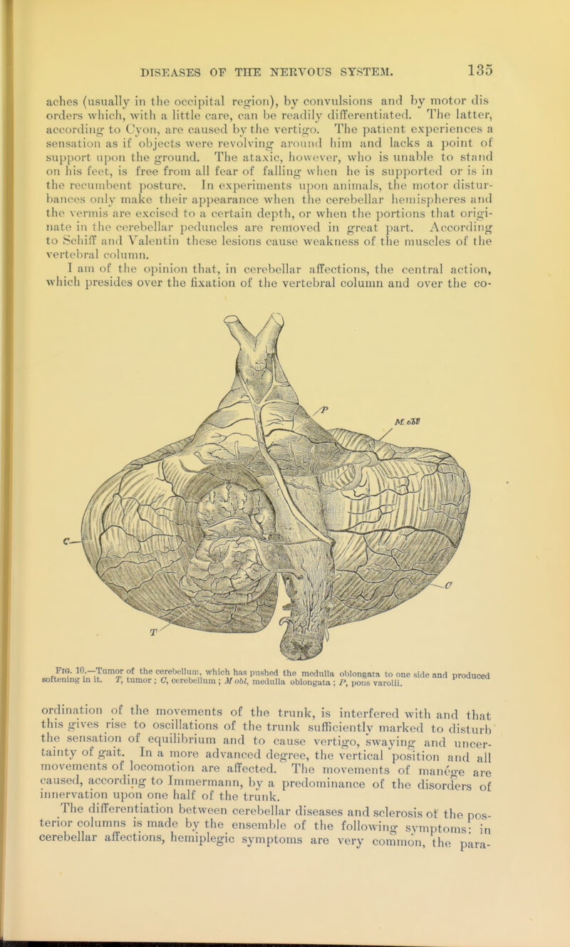 aches (usually in the occipital region), by convulsions and by motor dis orders which, with a little care, can be readily differentiated. The latter, accordino- to Cyon, are caused by the vertii^o. The patient experiences a sensation as if objects were revolving- around him and lacks a point of support upon the ground. The ataxic, however, who is unable to stand on his feet, is free from all fear of falling when he is supported or is in the recumbent posture. In experiments upon animals, the motor distur- bances only make their appearance when the cerebellar hemis])heres and the vermis are excised to a certain depth, or when the portions that origi- nate in the cerebellar peduncles are removed in great part. According to SchifP and Valentin these lesions cause weakness of the muscles of the vertebral cohmm. I am of the opinion that, in cerebellar affections, the central action, which presides over the fixation of the vertebral column and over the co- FiQ. 10.—Tumor of the cerebellum, which has pushed the medulla oblongata to one side and produced softening in it. T, tumor ; (7, cerebellum ; M obi, medulla oblongata ; P, pons varolii. ordination of the movements of the trutik, is interfered with and that this gives rise to oscillations of the trunk sufficientlv marked to disturb the sensation of equilibrium and to cause vertigo, swaying and uncer- tainty of gait. In a more advanced degree, the vertical position and all movements of locomotion are affected.' The movements of mantnre are caused, according to Imrnermann, by a predominance of the disorders of innervation upon one half of the trunk. The differentiation between cerebellar diseases and sclerosis of the pos- terior columns is made by the ensemble of the following symptoms- in cerebellar affections, hemiplegic symptoms are very common, the para-