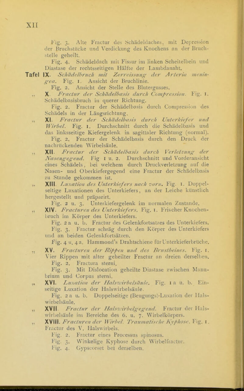 l'ig. 3. Alle Fractur des Schädeldaches, mit Depression der HruchsUicke und Verdickung des Knochens nn der Bruch- t-telle geheilt. Fig. 4. Schädeldach mit Fissur im linken ScheileH)ein und Diaslase der rechtsseitigen Ilälfie der Lanibdanaht, Tafel IX. Sc//e'i(/c//'f'//c/f mit Zcrrcissi/iis;- der Arlcria mciiin- gca. Fig. I. Ansicht der Bruchlinie. Fig. 2. Ansicht der Stelle des Blutergusses. X. Practiir der Scliädelhasis durcli Coinpressioii. Fig. I. Schädelbasisbruch in querer Richtung. Fig. 2. Fractur der Schädelbasis durch Conipres^ion des Schädels in der Längsrichtung. ,, XI. Fractur der Scliädclbasis durcli Unterkiefer und Wirbel. Fig. i. Durchschnitt durch die Schädelbasis und das linksseitige Kiefergelenk in sagittaler Richtung (normal). Fig. 2. Fractur der Schädelbasis durch den Druck der nachrückenden Wirbelsäule. ,, XII. Fractur der Schädelbasis durcli Verletzuu^'- der N^aseiigeg-end. Fig i u. 2. Durchschnitt und Vorderansicht eines Schädels, bei welchem durch Druckverletzung auf die Nasen- und Oberkiefergegend eine Fractur der Schädelbasis zu Stande gekommen ist. XIII. Luxation des Unterkiefers nach vom. Fig. i. Doppel- seitige Luxationen des Unterkiefers, an der Leiche künstlich hergestellt und präparirt. Fig. 2 u. 3. Unterkiefergelenk im normalen Zustande. ,, XIV. Fracturen des Unterkiefers. Fig. i. Frischer Knochen- liruch im Körper des Unterkiefers. Fig. 2 a u. b. Fractur des Gelenkfortsatzes des Unterkiefers. 3- Fractur schräg durch den Körper des Unterkiefers und an beiden Gelenkfortsätzen. Fig. 4 u. 4 a. Hammond's Drahtschiene für Unterkieferbrüche. „ XV. Fracturen der Rifpoi und. des Brustbeines. Fig. I. Vier Rippen mit alter geheilter Fractur an dreien derselb.en, Fig. 2. Fractura sterni. Fig. 3. Mit Dislocation geheilte Dia>tase zwischen Manu- brium und Corpus sterni. „ XVI. Luxation der Llals-virbehtiule. Fig. i a u. b. Fin- seitige Luxation der Halswirbelsäule. Fig. 2a u. b. Doppelseitige (BeugungsVLuxation der lials- wirbelsäule. „ XVII. Fractur der J/als-virbeli;ei;end. Fractur der Mals- wirbelsäule im Bereiche des 6. u. 7. Wirbelkörpers. „ XVIII. Fracturen der Wirbel. Trauinatisrhe k'v/>liose. Fig. i. Fr;;clur des V. Halswirbels. Fig. 2. Fractur eines Processus spinosus. ^''.äi- 3- Winkelige Kyphose durch Wirbelfractur. Fig. 4. Ciypscorset bei derselben. ■