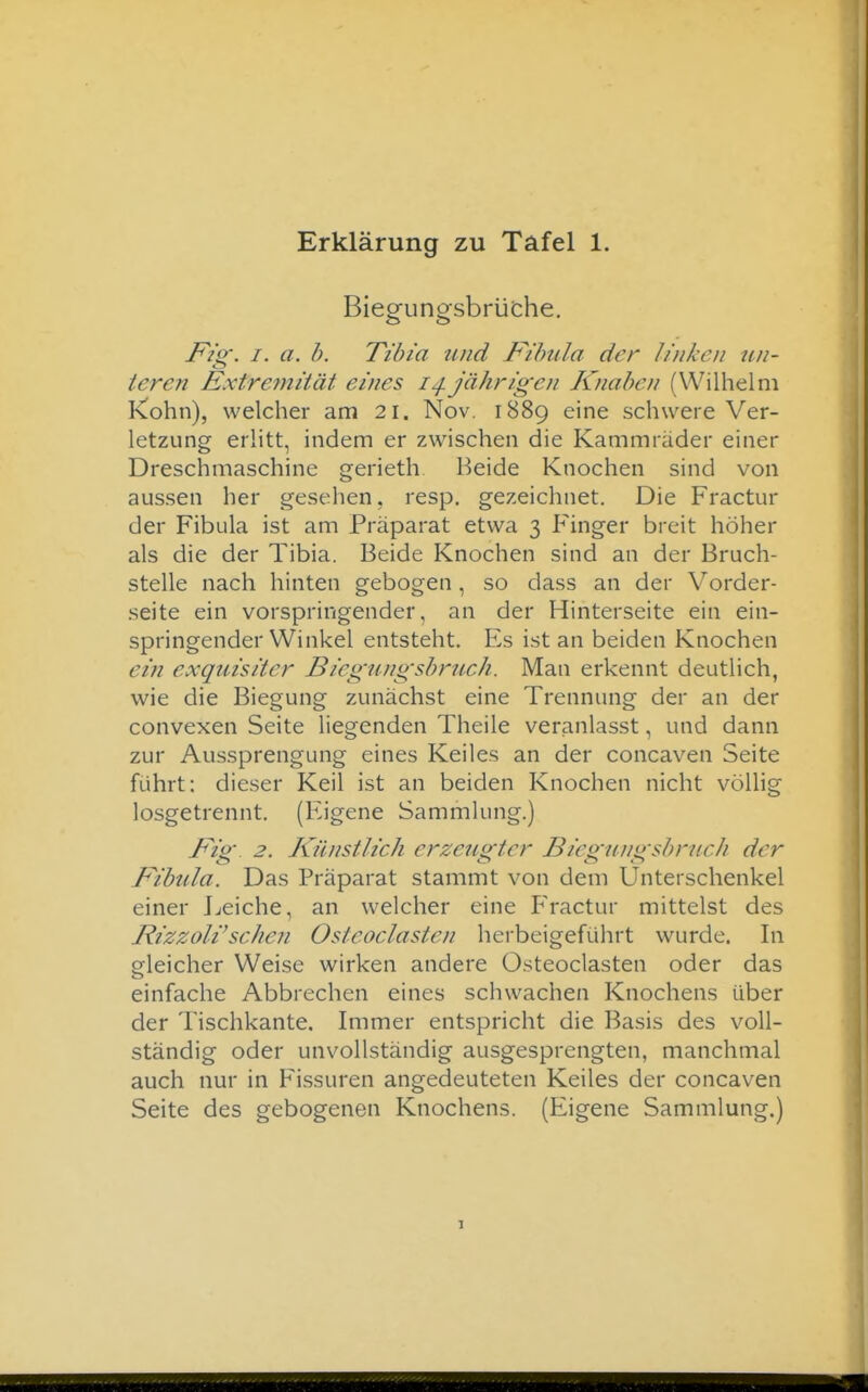 Biegungsbrüche, I^zg. I. a. b. Tibia und Fibula der linken un- teren Extretnität eines Jährigen Knaben (Wilhelm K!ohn), welcher am 21. Nov. 1889 eine schwere Ver- letzung erlitt, indem er zwischen die Kammräder einer Dreschmaschine gerieth Beide Knochen sind von aussen her gesehen, resp. gezeichnet. Die Fractur der Fibula ist am Präparat etwa 3 Finger breit höher als die der Tibia. Beide Knochen sind an der Bruch- stelle nach hinten gebogen , so dass an der Vorder- seite ein vorspringender, an der Hinterseite ein ein- springender Winkel entsteht. Es ist an beiden Knochen ein exquisiter Biegungsbruch. Man erkennt deutlich, wie die Biegung zunächst eine Trennung der an der convexen Seite liegenden Theile veranlasst, und dann zur Aussprengung eines Keiles an der concaven Seite führt: dieser Keil ist an beiden Knochen nicht völlig losgetrennt. (Eigene Sammlung.) Fig. 2. Künstlich erzeugter Biegungsbruch der Fibula. Das Präparat stammt von dem Unterschenkel einer Leiche, an welcher eine Fractur mittelst des RizzoWsehen Osteoclasten herbeigeführt wurde. In gleicher Weise wirken andere Osteoclasten oder das einfache Abbrechen eines schwachen Knochens über der Tischkante. Immer entspricht die Basis des voll- ständig oder unvollständig ausgesprengten, manchmal auch nur in Fissuren angedeuteten Keiles der concaven Seite des gebogenen Knochens. (Eigene Sammlung.)