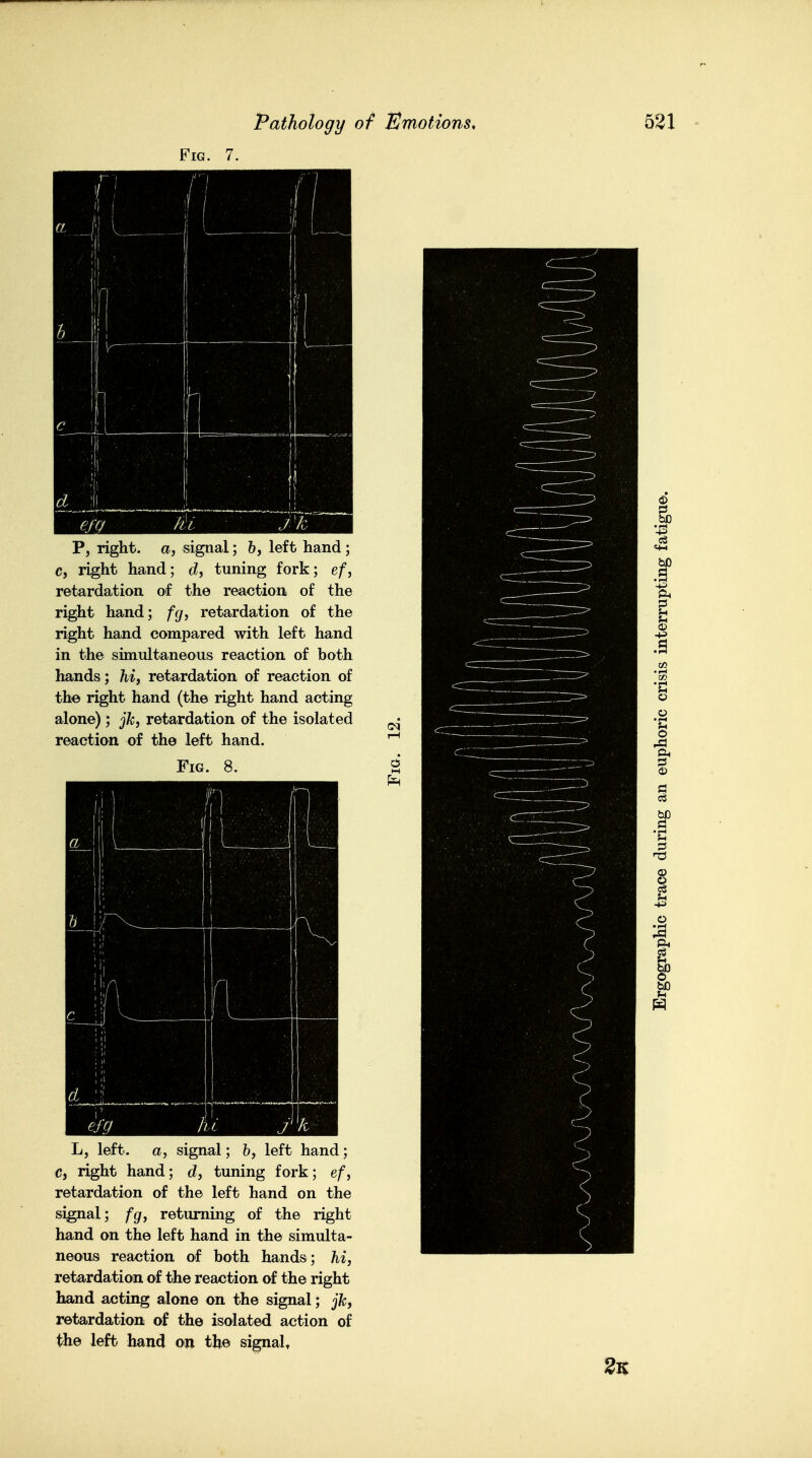 Fig. 7. a fl I ____ 1 !J ( 1 \ 5 J! 1 1 1, ■ ' I ^ , 1 ■ 1 1 i d i _j ! t ^- _ 1.1 ■ efcjf it P, right, a, signal; &, left hand; c, right hand; timing fork; e/, retardation of the reaction of the right hand; f(j^ retardation of the right hand compared with left hand in the simultaneous reaction of both hands; /li, retardation of reaction of the right hand (the right hand acting alone); j/c, retardation of the isolated reaction of the left hand. Fig. 8. L, left, a, signal; &, left hand; c, right hand; c?, tuning fork; e/, retardation of the left hand on the signal; fgf, returning of the right hand on the left hand in the simulta- neous reaction of both hands; /li, retardation of the reaction of the right hand acting alone on the signal; jfc, retardation of the isolated action of the left band on the signal^