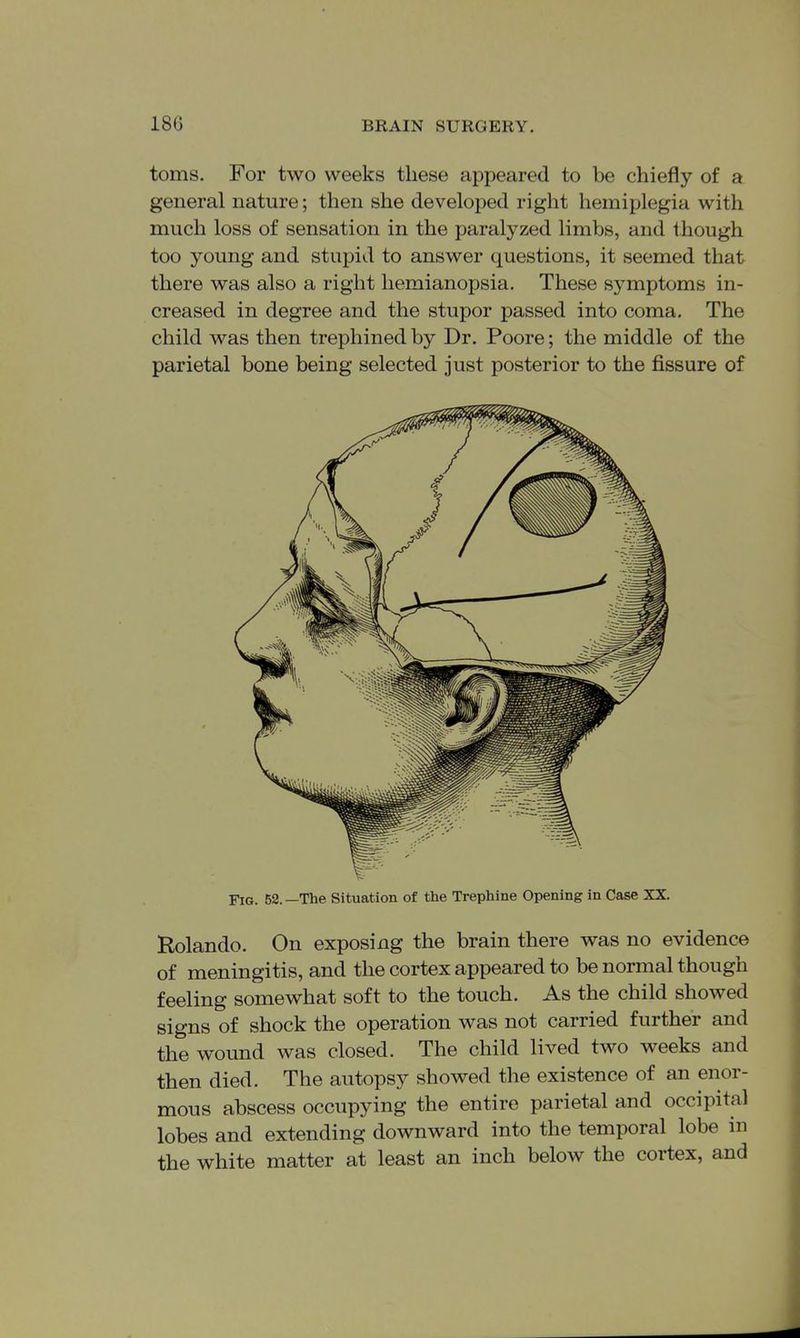 toms. For two weeks these appeared to be chiefly of a general nature; then she developed right hemiplegia with much loss of sensation in the paralyzed limbs, and though too young and stupid to answer questions, it seemed that there was also a right hemianopsia. These symptoms in- creased in degree and the stupor passed into coma. The child was then trephined by Dr. Poore; the middle of the parietal bone being selected just posterior to the fissure of Fig. 52.—The Situation of the Trephine Opening in Case XX. Rolando. On exposing the brain there was no evidence of meningitis, and the cortex appeared to be normal though feeling somewhat soft to the touch. As the child showed signs of shock the operation was not carried further and the wound was closed. The child lived two weeks and then died. The autopsy showed the existence of an enor- mous abscess occupying the entire parietal and occipital lobes and extending downward into the temporal lobe in the white matter at least an inch below the cortex, and