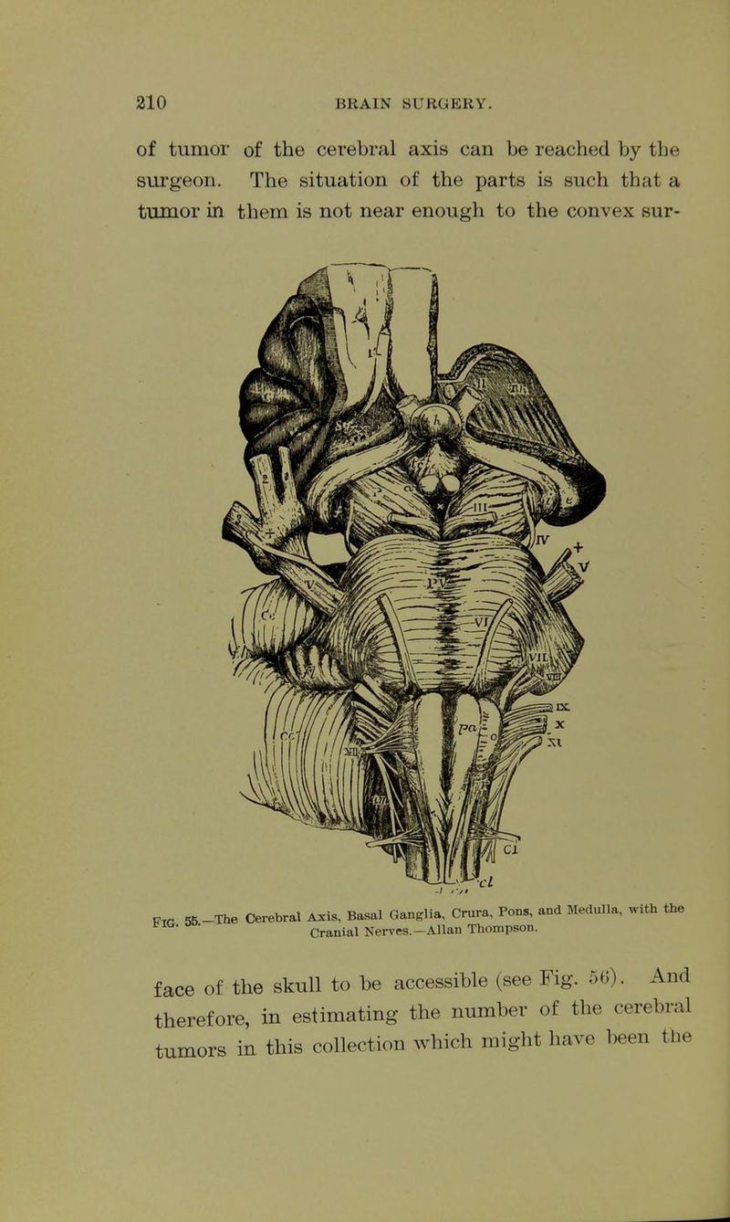 of tumor of the cerebral axis can be reached by the surgeon. The situation of the parts is such that a tumor in them is not near enough to the convex sur- Prr 55 -The Cerebral Axis, Basal Ganglia, Crura, Pons, and Medulla, with the Cranial Nerves.—Allan Thompson. face of the skull to be accessible (see Fig. 56). And therefore, in estimating the number of the cerebral tumors in this collection which might have been the