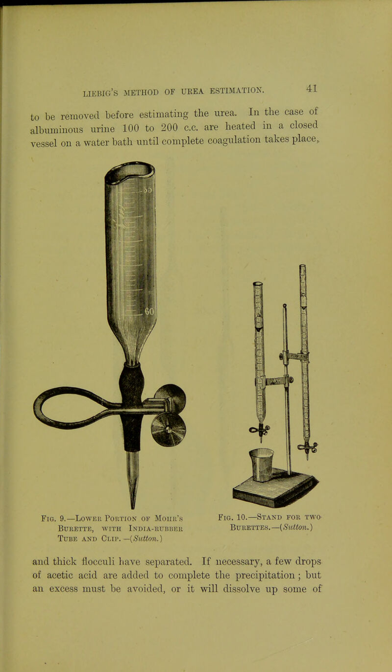 to be removed before estimating the urea. In the case of albuminous urine 100 to 200 c.c. are heated in a closed vessel on a water bath until complete coagulation takes place, Fig. 9.—Lower Portion of Hour's Fig. 10.—Stand for two Burette, with India-rubber Burettes.—(S'ttWon.) Tube and Clip. —{Sutton.) and thick flocculi have separated. If necessary, a few drops of acetic acid are added to complete the precipitation; but an excess must be avoided, or it will dissolve up some of