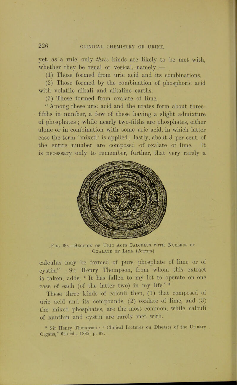 yet, as a rule, only three kinds are likely to be met with, whether they be renal or vesical, namely:— (1) Those formed from uric acid and its combinations. (2) Those formed by the combination of phosphoric acid with volatile alkali and alkaline earths. (3) Those formed from oxalate of lime.  Among these uric acid and the urates form about three- fifths in number, a few of these having a slight admixture of phosphates ; while nearly two-fifths are phosphates, either alone or in combination with some uric acid, in which latter •case the term ' mixed' is applied ; lastly, about 3 per cent, of the entire number are composed of oxalate of lime. It is necessary only to remember, further, that very rarely a Fig. 60.—Section of Ukic Acid Calcitllts with Nucleus of Oxalate of Lime {Bryant). calculus may be formed of pure phosphate of lime or of cystin. Sir Henry Thompson, from whom this extract is taken, adds,  It has fallen to my lot to operate on one ■case of each (of the latter two) in my life.* These three kinds of calculi, then, (1) that composed of uric acid and its compounds, (2) oxalate of lime, and (3) the mixed phosphates, are the most common, while calculi of xanthin and cystin are rarely met with. * Sir Henry Thompson : Clinical Lectures on Diseases of the Urinary Organs, 6th ed., 1882, p. 67.