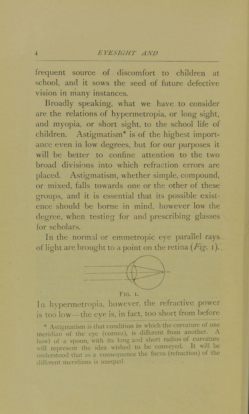 frequent source of discomfort to children at school, and it sows the seed of future defective vision in many instances. Broadly speaking, what we have to consider are the relations of hypermetropia, or long sight, and myopia, or short sight, to the school life of children. Astigmatism* is of the highest import- ance even in low degrees, but for our purposes it will be better to confine attention to the two broad divisions into which refraction errors are placed. Astigmatism, whether simple, compound, or mixed, falls towards one or the other of these groups, and it is essential that its possible exist- ence should be borne in mind, however low the degree, when testing for and prescribing glasses for scholars. In the normal or emmetropic eye parallel rays of light are brought to a point on the retina [Fig. i). X. Fig. i. In hypermetropia, however, the refractive power is too low—the eye is, in fact, too short from before * Astigmatism is that condition in which the curvature of one meridian' of the eye (cornea), is different from another. A howl of a spoon, with its long and short radius of curvature will represent the idea wished to be conveyed. It will be understood that as a consequence the focus (refraction) of the different meridians is unequal.