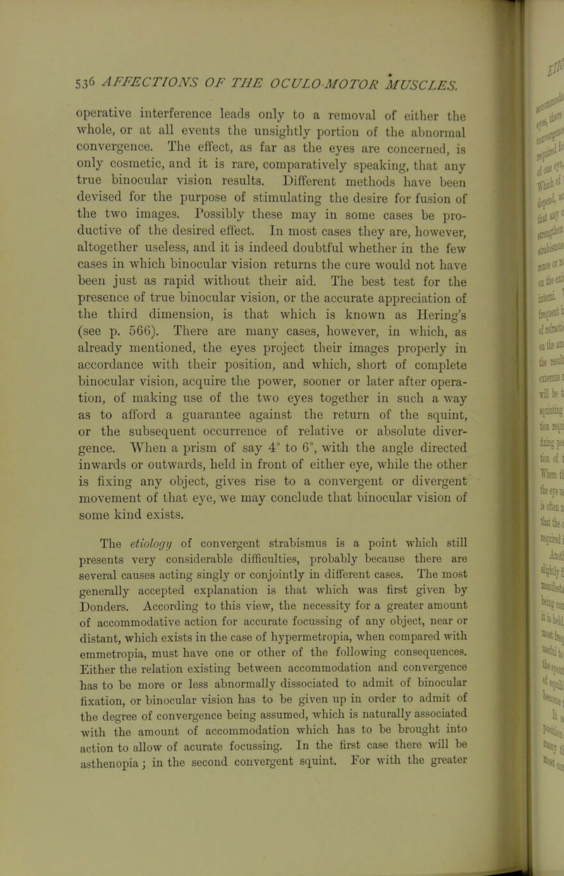 operative interference leads only to a removal of either the whole, or at all events the unsightly portion of the abnormal convergence. The effect, as far as the eyes are concerned, is only cosmetic, and it is rare, comparatively speaking, that any true binocular vision results. Different methods have been devised for the purpose of stimulating the desire for fusion of the two images. Possibly these may in some cases be pro- ductive of the desired effect. In most cases they are, however, altogether useless, and it is indeed doubtful whether in the few cases in which binocular vision returns the cure would not have been just as rapid without their aid. The best test for the presence of true binocular vision, or the accurate appreciation of the third dimension, is that which is known as Hering's (see p. 566). There are many cases, however, in which, as already mentioned, the eyes project their images properly in accordance with tlieir position, and which, short of complete binocular vision, acquire the power, sooner or later after opera- tion, of making use of the two eyes together in such a way as to afford a guarantee against the return of the squint, or the subsequent occurrence of relative or absolute diver- gence. When a prism of say 4° to 6°, with the angle directed inwards or outwards, held in front of either eye, while the other is fixing any object, gives rise to a convergent or divergent movement of that eye, we may conclude that binocular vision of some kind exists. The etiologii of convergent strabismus is a point which still presents very considerable difficulties, probably because there are several causes acting singly or conjointly in different cases. The most generally accepted explanation is that which was first given by Bonders. According to this view, the necessity for a greater amount of accommodative action for accurate focussing of any object, near or distant, which exists in the case of hypermetropia, when compared with emmetropia, must have one or other of the following consequences. Either the relation existing between accommodation and convergence has to be more or less abnormally dissociated to admit of binocular fixation, or binocular vision has to be given up in order to admit of the degree of convergence being assumed, which is naturally associated with the amount of accommodation which has to be brought into action to allow of acurate focussing. In the first case there will be asthenopia; in the second convergent squint. For with the greater