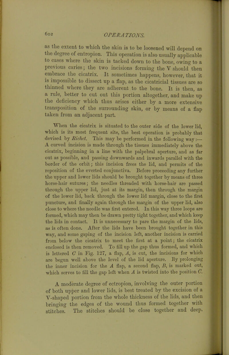 as tlie extent to which the skin is to be loosened will depend on the degree of entropion. Tliis operation is also usually applicable to cases where the skin is tacked down to the bone, owing to a previous caries; the two incisions forming the V should then embrace the cicatrix. It sometimes happens, however, that it is impossible to dissect up a flap, as the cicatricial tissues are so thinned where they are adherent to the bone. It is then, as a rule, better to cut out this portion altogether, and make up the deficiency which thus arises either by a more extensive transposition of the surrounding skin, or by means of a flap taken from an adjacent part. When the cicatrix is situated to the outer side of the lower lid, which is its most frequent site, the best operation is probably that devised by Richet. This may be performed in the following way :— A curved incision is made through the tissues immediately above the cicatrix, beginning in a line with the palpebral aperture, and as far out as possible, and passing downwards and inwards parallel with the border of the orbit; this incision frees the lid, and permits of the reposition of the everted conjunctiva. Before proceeding any further the upper and lower lids should be brought together by means of three horse-hair sutures; the needles threaded with horse-hair are passed through the upper lid, just at its margin, then through the margin of the lower lid, back through the lower lid margin, close to the first puncture, and finally again through the margin of the upper lid, also close to where the needle was first entered. In this way three loops are formed, which may then be drawn pretty tight together, and which keep the hds in contact. It is unnecessary to pare the margin of the lids, as is often done. After the lids have been brought together in this way, and some gaping of the incision left, another incision is carried from below the cicatrix to meet the first at a point; the cicatrix enclosed is then removed. To fill up the gap thus formed, and which is lettered C in Fig. 127, a flap, A, is cut, the incisions for which are begun well above the level of the lid aperture. Ey prolonging the inner incision for the A flap, a second flap, B, is marked out, which serves to fill the gap left when A is twisted into the position C. A moderate degree of ectropion, involving the outer portion of both upper and lower lids, is best treated by the excision of a V-shaped portion from the whole thickness of the lids, and then bringing the edges of the wound thus formed together with stitches. The stitches should be close together and deep.