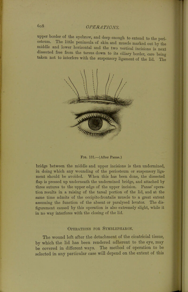 upper border of the eyebrow, and deep enough to extend to the peri- osteum. The little peninsula of skin and muscle marked out by the middle and lower horizontal and the two vertical incisions is next dissected free from the tarsus down to its ciliary border, care being taken not to interfere with the suspensory ligament of the lid. The bridge between the middle and upper incisions is then undermined, in doing which any wounding of the periosteum or suspensory liga- ment should be avoided. When this has been done, the dissected flap is pressed up underneath the undermined bridge, and attached by three sutures to the upper edge of the upper incision. Panas' opera- tion results in a raising of the tarsal portion of the lid, and at the same time admits of the occipito-frontalis muscle to a great extent assuming the function of the absent or paralysed levator. The dis- figurement caused by this operation is also extremely slight, while it in no way interferes with the closing of the lid. The wound left after the detachment of the cicatricial tissue, by which the lid has been rendered adherent to the eye, may be covered in different ways. The method of operation to be selected in any particular case will depend on the extent of this Fig. 131.—(After Panas.) Operations for Symblepharon.