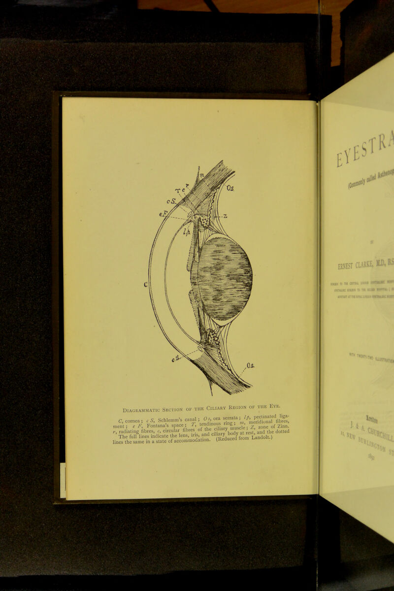 DIAGRAMMATIC SECTION OK THE ClLIARY REGION OF THE EVE. ment; c F, Fontana s space ; ^'^ ^'^scle ; Z, zone of Zinn. r, radiating fibres, c, circular fibres of Yinrv bodv at rest and the dotted The full Hnes indicate the lens, n is and ^^l E;^, lines the same in a state of accommoaation. (Reduced irom i.ani (Col A8I ERNEST CLARKE, M.D. sticKiK TO m amu. i'™* omnAuiic si E!