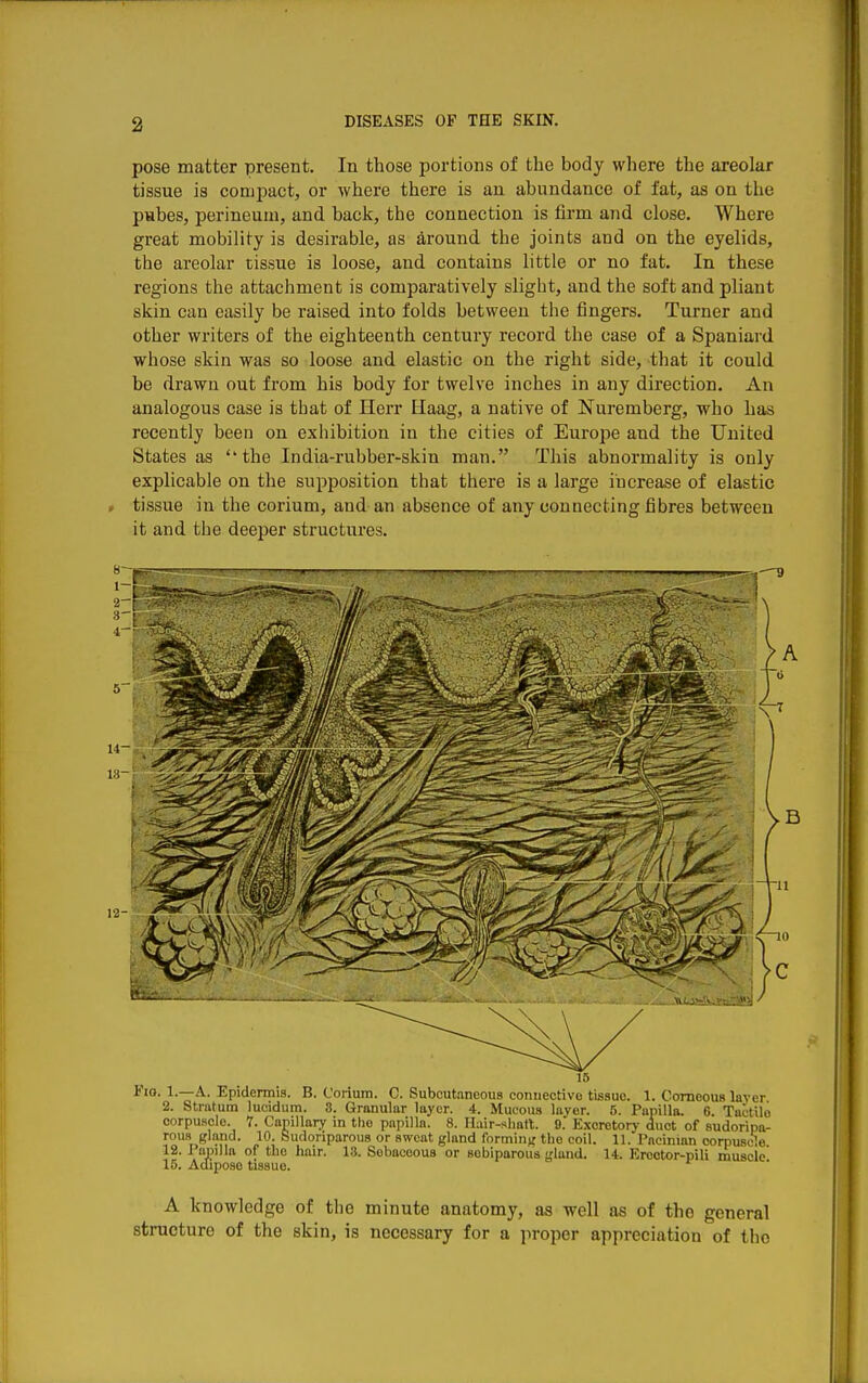 pose matter present. In those portions of the body where the areolar tissue is compact, or where there is an abundance of fat, as on the pubes, perineum, and back, the connection is firm and close. Where great mobility is desirable, as Ground the joints and on the eyelids, the areolar tissue is loose, and contains little or no fat. In these regions the attachment is comparatively slight, and the soft and pliant skin can easily be raised into folds between the fingers. Turner and other writers of the eighteenth century record the case of a Spaniard whose skin was so loose and elastic on the right side, that it could be drawn out from his body for twelve inches in any direction. An analogous case is that of Herr Haag, a native of Nuremberg, who has recently been on exhibition in the cities of Europe and the United States as the India-rubber-skin man. This abnormality is only explicable on the supposition that there is a large increase of elastic , tissue in the corium, and an absence of any connecting fibres between it and the deeper structures. 15 iio. 1.—A. Epidermis. B. Corium. C. Subcutaneous connective tissue. 1. Corneous layer 2. Stratum lucidum. 8. Granular layer. 4. Mucous layer. 5. Papilla. 6. Tactile corpuscle. 7. Capillary in tlio papilla. 8. Ilair-shart. 9. Excretory duct of sudoripa- rous gland. 10. Sudoriparous or sweat gland forming the coil. 11. Pacinian corpuscle 12. Papilla of the hair. 13. Sebaceous or sobiparous gland. 14. Erootor-pili muscle 15. Adipose tissue. A knowledge of the minute anatomy, as well as of the general structure of the skin, is necessary for a proper appreciation of the