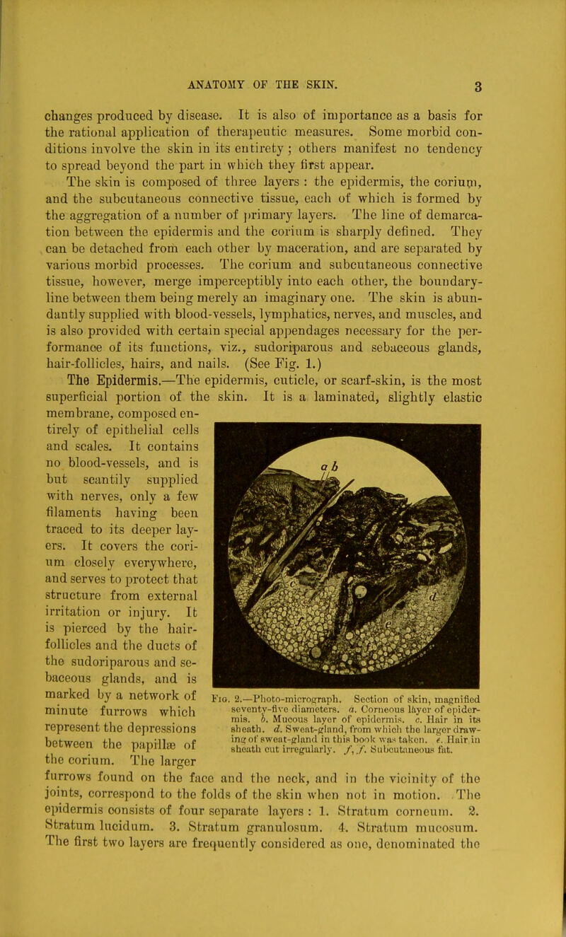 changes produced by disease. It is also of importance as a basis for the rational application of therapeutic measures. Some morbid con- ditions involve the skin in its entirety; others manifest no tendency to spread beyond the part in which they first appear. The skin is composed of three layers : the epidermis, the coriupi, and the subcutaneous connective tissue, each of which is formed by the aggregation of a number of jirimary layers. The line of demarca- tion between the epidermis and the corium is sharply defined. They can be detached from each other by maceration, and are separated by various morbid processes. The corium and subcutaneous connective tissue, however, merge imperceptibly into each other, the boundary- line between them being merely an imaginary one. The skin is abun- dantly supplied with blood-vessels, lymphatics, nerves, and muscles, and is also provided with certain special appendages necessary for the per- formance of its functions, viz., sudoriparous and sebaceous glands, hair-follicles, hairs, and nails. (See Fig. 1.) The Epidermis.—The epidermis, cuticle, or scarf-skin, is the most superficial portion of the skin. It is a laminated, slightly elastic membrane, composed en- tirely of epithelial cells and scales. It contains no blood-vessels, and is but scantily supplied with nerves, only a few filaments having been traced to its deeper lay- ers. It covers the cori- um closely everywhere, and serves to protect that structure from external irritation or injury. It is pierced by the hair- follicles and the ducts of the sudoriparous and se- baceous glands, and is marked by a network of minute furrows which represent the depressions between the papillee of the corium. The larger furrows found on the face and the neck, and in the vicinity of the joints, correspond to the folds of the skin when not in motion. The epidermis consists of four separate layers: 1. Stratum corncum. 2. Stratum lucidum. 3. Stratum granulosum. 4. Stratum mucosum. The first two layers are frequently considered as one, denominated the Fio. 2.—Flioto-micrograph. Section of skin, magnified scvontv-flvc diameters, a. Corneous Ihycr of opidei^ mis. h. Mucous layer of epidermis, c. Hair in its sheath, d. Swoat-ffland, from wiiicli the larger draw- ing of Bweat-frland in this book was taken, e. Ilair in sheath cut irregularly. /,./'. iSuljcuUmeoufi fat.
