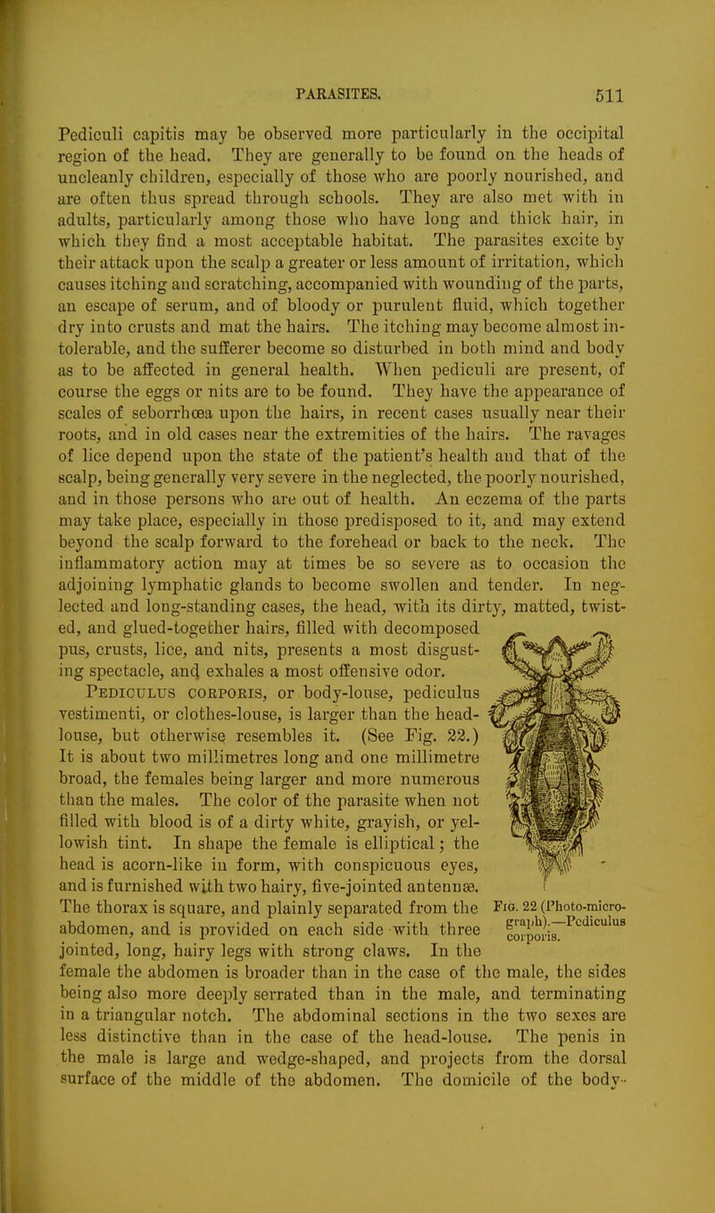 Pediculi capitis may be observed more particularly in the occipital region of the head. They are generally to be found on the heads of uncleanly children, especially of those who are poorly nourished, and are often thus spread through schools. They are also met with in adults, particularly among those who have long and thick hair, in which thoy find a most acceptable habitat. The parasites excite by their attack upon the scalp a greater or less amount of irritation, which causes itching and scratching, accompanied with wounding of the parts, an escape of serum, and of bloody or purulent fluid, which together dry into crusts and mat the hairs. The itching may become almost in- tolerable, and the sufferer become so disturbed in both mind and body as to be affected in general health. When pediculi are present, of course the eggs or nits are to be found. They have the appearance of scales of seborrhcea upon the hairs, in recent cases usually near their roots, and in old cases near the extremities of the hairs. The ravages of lice depend upon the state of the patient's health and that of the scalp, being generally very severe in the neglected, the poorly nourished, and in those persons who are out of health. An eczema of the parts may take place, especially in those predisposed to it, and may extend beyond the scalp forward to the forehead or back to the neck. The inflammatory action may at times be so severe as to occasion the adjoining lymphatic glands to become swollen and tender. In neg- lected and long-standing cases, the head, with its dirty, matted, twist- ed, and glued-together hairs, filled with decomposed pus, crusts, lice, and nits, presents a most disgust- ing spectacle, and exhales a most offensive odor. Pediculus corporis, or body-louse, pediculus vestimenti, or clothes-louse, is larger than the head- louse, but otherwise resembles it. (See Fig. 23.) It is about two millimetres long and one millimetre broad, the females being larger and more numerous than the males. The color of the parasite when not filled with blood is of a dirty white, grayish, or yel- lowish tint. In shape the female is elliptical; the head is acorn-like in form, with conspicuous eyes, and is furnished with two hairy, five-jointed antennse. The thorax is square, and plainly separated from the Fid. 22 (Photo-micro- abdomen, and is provided on each side with three corporisT^'^'^^^'^^^ jointed, long, hairy legs with strong claws. In the female the abdomen is broader than in the case of the male, the sides being also more deeply serrated than in the male, and terminating in a triangular notch. The abdominal sections in the two sexes are less distinctive than in the case of the head-louse. The penis in the male is large and wedge-shaped, and projects from the dorsal surface of the middle of the abdomen. The domicile of the body-