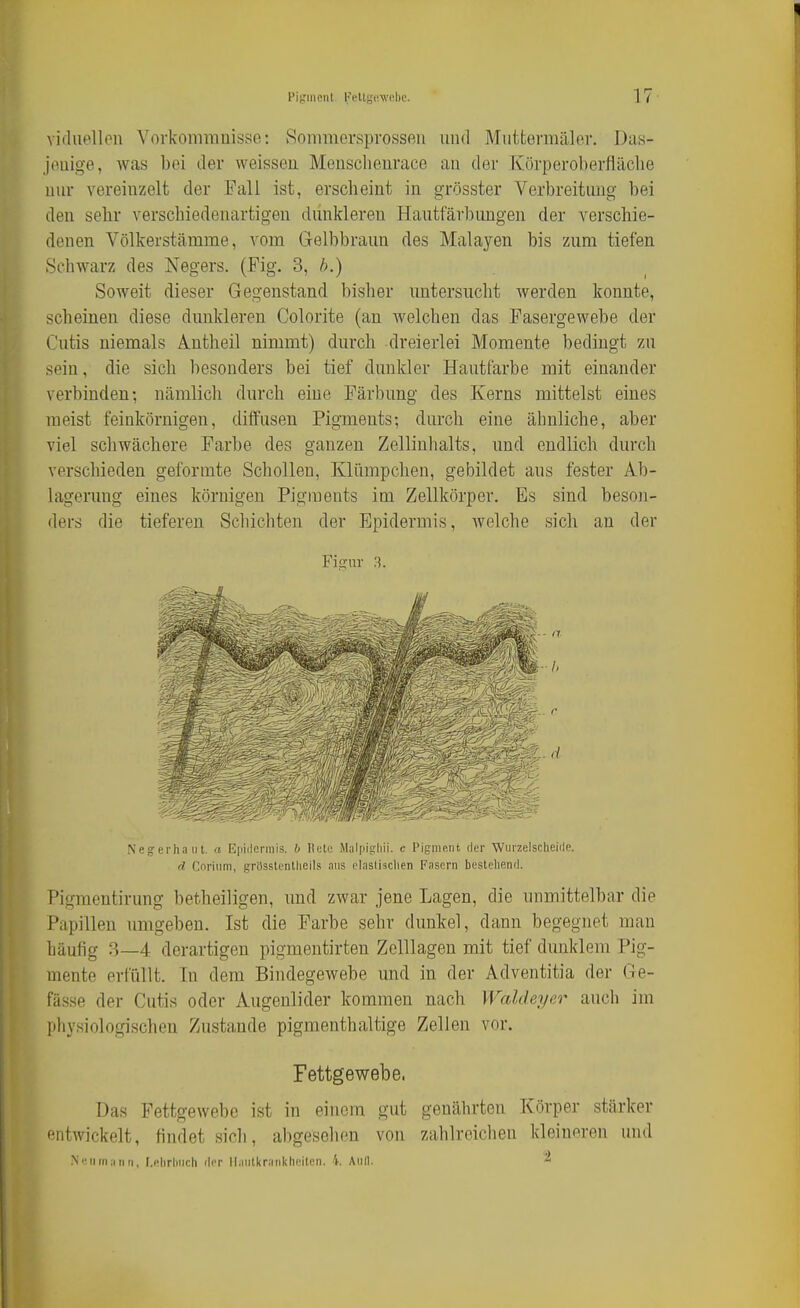 Pigment Feltgüwehe. 17- vifluellon Vovkomrauisse: Sommersprossen iiiul Miittermäler, Das- jenige, was bei der weissen Menschenrace an der Körperoberfläclie nur vereinzelt der Fall ist, erscheint in grösster Verbreitung bei den sebr verschiedenartigen dunkleren Hantfärbungen der verschie- denen Völkerstämme, vom Gelbbraun des Malayen bis zum tiefen Schwarz des Negers. (Fig. 3, />.) Soweit dieser Gegenstand bisher untersucht werden konnte, scheinen diese dunkleren Colorite (an welchen das Fasergewebe der Cutis niemals Ä.ntheil nimmt) durch dreierlei Momente bedingt zu sein, die sich besonders bei tief dunkler Hautfarbe mit einander verbinden; nämlich durch eine Färbung des Kerns mittelst eines raeist feinkörnigen, diffusen Pigments; durch eine ähnliche, aber viel schwächere Farbe des ganzen Zellinhalts, und endlich durch verschieden geformte Scliolleu, Klümpchen, gebildet aus fester Ab- lagerung eines körnigen Pigments im Zellkörper. Es sind beson- ders die tieferen Schichten der Epidermis, welche sich an der Fi£rur 8. Ne^erhaiit. a Epiilormis. 6 licte Malpighii. c Pigment fler Wurzelscheide. d Cnrinm, grössicntlieils ans elaslisclien Fasern bestellend. Pigraentirung betheiligen, und zwar jene Lagen, die unmittelbar die Papillen umgeben. Ist die Farbe sehr dunkel, dann begegnet man häufig 8—4 derartigen pigmentirten Zelllagen mit tief dunklem Pig- mente erfüllt. Tu dem Bindegewebe und in der Adventitia der Ge- fässe der Cutis oder Augenlider kommen nach Waldeyer auch im physiologischen Zustande pigmenthaltige Zellen vor. Fettgewebe. Das Fettgewebe ist in einem gut genährten Körper stärker '■iitwickelt, findet sich, abgesolien von zahlreichen kleineren und N'Ml mann, I.filirlincli der llaiitl(ranl<heiten. 4. Aull.
