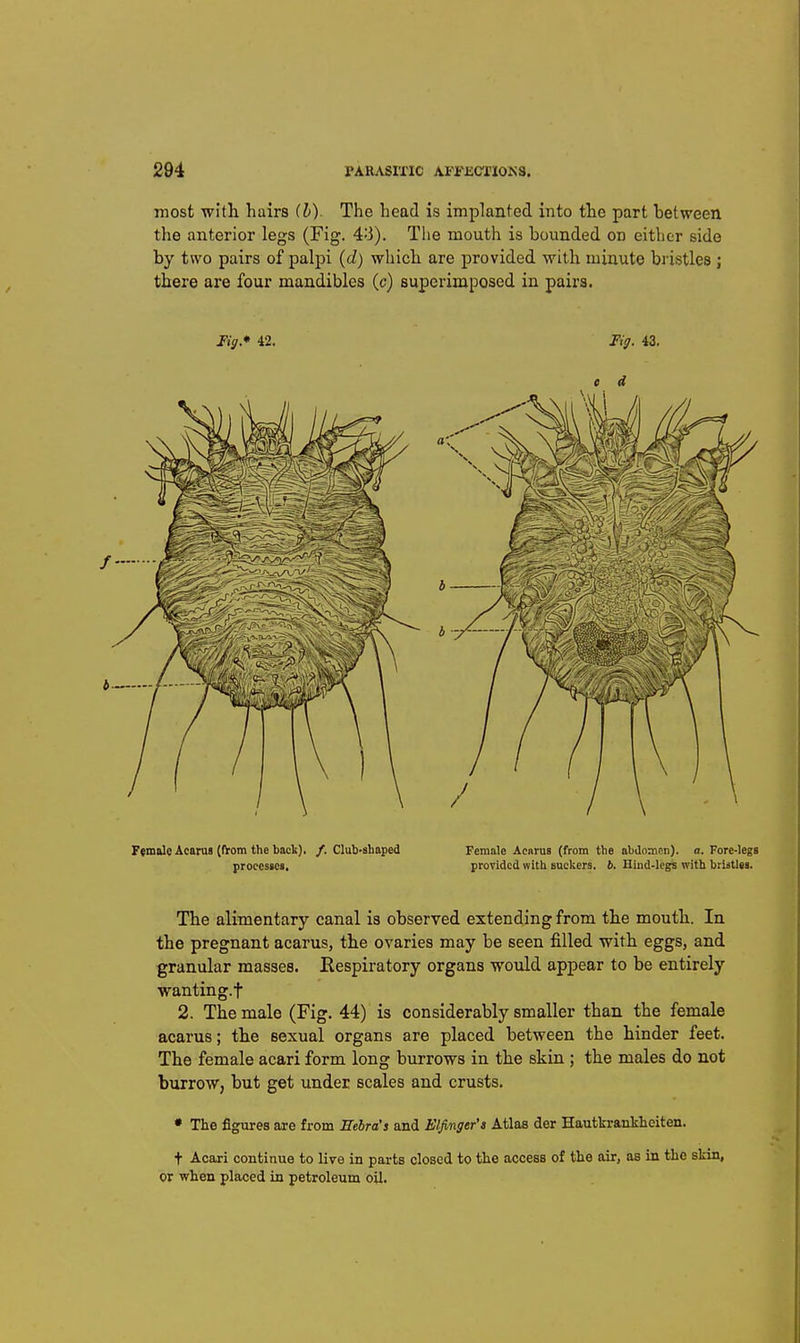 204 rARASIXIC AFi'JiCriOKS. most with, hairs (h). The head is implanted into the part between the anterior legs (Fig. 4:3). Tlie mouth is bounded on either side by two pairs of palpi (d) which are provided with minute bristles j there are four mandibles (c) superimposed in pairs. Tiff* 42. FtmoleAcaruB (IVom the back), /. Club-shaped procesaea. Female Aearus (from the abdomen), a. Fore-legs provided with suckers, b. Hiud-lcg^ with bristles. The alimentary canal is observed extending from the mouth. In the pregnant acarus, the ovaries may be seen filled with eggs, and granular masses. Eespiratory organs woxild appear to be entirely wanting.t 2. The male (Fig. 44) is considerably smaller than the female acarus; the sexual organs are placed between the hinder feet. The female acari form long burrows in the skin ; the males do not burrow, but get under scales and crusts. • The figures are from Eebra's and Elfinger's Atlas der Hautkranklieiten. t Acari continue to live in parts closed to the access of the air, as in the skin, or when placed in petroleum oU.