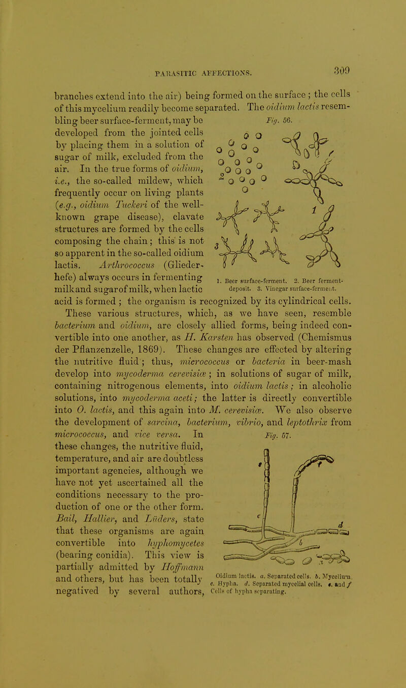 brandies extend into the nir) being formed on tlie surface ; the cells of this mycelium readily become separated. The oidhmi laciis resem- bling beer surface-ferment, may be Fiff. 56. developed from the jointed cells by placing them in a solution of sugar of milk, excluded from the air. In the true forms of oiclium, i.e., the so-called mildew, which frequently occur on living plants {e.g., oidium Tucheri of the well- known grape disease), clavate structures are formed by the cells composing the chain; this' is not so apparent in the so-called oidium lactis. Arthrococcus (Glieder- hefe) alwaj's occurs in fermenting milk and sugar of milk, when lactic acid is formed ; the organism is recognized by its cylindrical cells. These various structures, which, as we have seen, resemble hactermm and oidium, are closely allied forms, being indeed con- vertible into one another, as H. Karsten has observed (Chemismus der Pflanzenzelle, 1869). These changes are effected by altering the nutritive fluid ; thus, micrococcus or bacteria in beer-mash develop into mycoderma cerevisice ; in solutions of sugar of milk, containing nitrogenous elements, into oidium lactis; in alcoholic solutions, into mycoderma aceti; the latter is directly convertible into 0. lactis, and this again into M. cerevisice. We also observe the development of sarcina, bacterium, vibrio, and leptothrix from 1. Beer suiface-rerment. 2. Beer ferment- deposit. 3. Vinegar surface-ferment. micrococcus, and vice versa. In these changes, the nutritive fluid, temperature, and air are doubtless important agencies, although we have not yet ascertained all the conditions necessary to the pro- duction of one or the other form. Bail, Hallier, and Lilders, state that these organisms are again convertible into hyphomycetes (bearing conidia). This view is partially admitted by Hoffmann and others, but has been totally negatived by several authors. Fig. 67. Oidium lactis. a. Separated cells. 6. Srycelium. c. Hyplia. rf. Separated mycelial cells. «. Bud/ Cells of liypha separating.