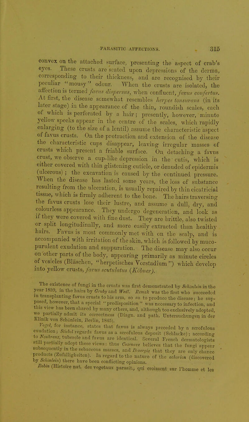convex on the attached surface, presenting the aspect of crah's eyes. These crusts are seated upon depressions of the derma, corresponding to their thickness, and are recognised by their peculiar mousy odour. When the crusts are isolated, the affection is termed fcivus dispersus, when confluent, favus confertus. At first, tlie disease somewhat resembles herjies ionsitrans (in its later stage) in the appearance of the Ihin, roundish scales, each of which is perforated by a hair; prcsentl3^ however, minute 3-elIow specks ajopear in the centre of tlie scales, which rapidly enlarging (to the size of a lentil) assume the characteristic aspect of favus crusts. On the protraction and extension of the disease the characteristic cups disappear, leaving irregular masses of crusts which present a friable surface. On detaching a favus crust, we observe a cup-like depression in the ■ cutis, which is either covered with thin glistening cuticle, or denuded of epidermis (ulcerous) ; the excavation is caused by the continued pressure. When the disease has lasted some years, the loss of substance resulting from the ulceration, is usually repaired by thin cicatricial tissue, which is firmly adherent to the bone. The hairs traversing the favus crusts lose their lustre, and assume a dull, dry, and colourless appearance. They undergo degeneration, and look as if they were covered with fine dust. They are brittle, also twisted or ^split longitudinally, and more easily extracted than healthy hairs. Favus is most commonly met with on the scalp, and is accompanied with irritation of the skin, which is followed by muco- purulent exudation and suppuration. The disease may also occur on'other parts of the body, appearing primarily as minute circles of vesicles (Blaschen, herpetisches Yorstadiurn ) which develop into yellow crusts,/arws scutulatiis {Kohner). The existence of fungi in the crusts was first demonstrated by Schonlein in the year 1839, m the hairs by Gruby and Wedl. Jiemak was the first who succeeded m transplanting favus crusts to his arm, so ns to produce the disease; ho sup- posed, however, that a special predisposition was necessary to infection, and this view has been shared by many others, and, although too exclusively adopted, we partially admit its correctness (Diagn. and path. Untersuchungen in der Klinik von Schonlein, Berlin, 1845). Vogd, for instance, states that favus is always preceded by a scrofulous exuflation; 5^ieW regards favus as a scrofulous deposit (Schlacke); accordincr ioj^eukranz tubercle and favus are identical. Several French dermatologists still partially adopt these vie^s: thus Cazmove believes that the fungi aiiTperr subsequently in the sebaceous masses. ^n,\ D.vergic that they are only chance products (Zufulhgkeiten). In regard to the nature of the achorion (discovered by bclwnleiii) there have been conflicting opinions. /^66/n(Hi8toirenat. des vegetaux parasit., qui cvoissent sur I'homme et les