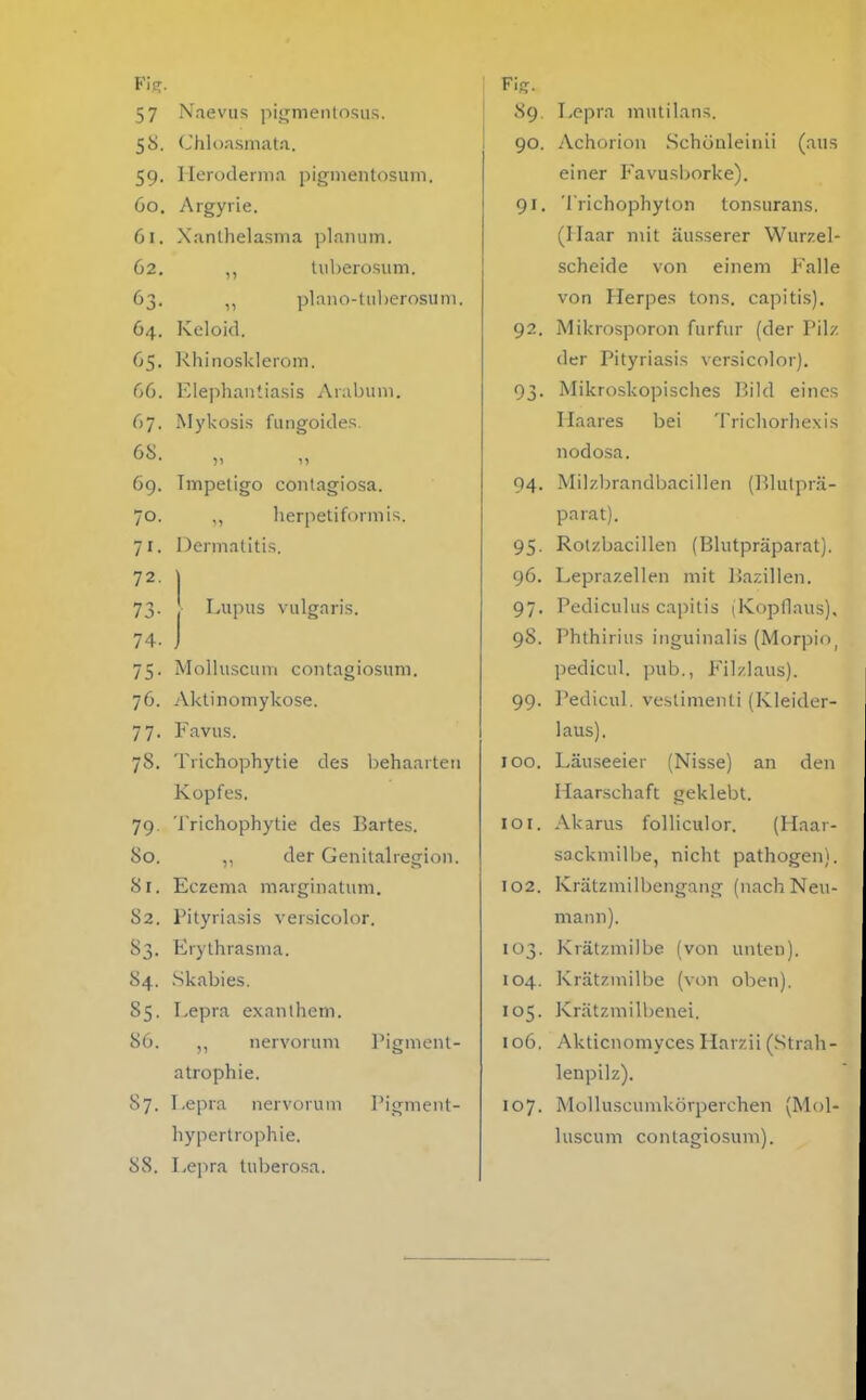 Fi?. 57 Naeviis pitjmenlosus. 58. (Jhlonsmat.i. 59. Ileroclerma pigmenlosum. 60. Argyrie. 61. Xanthelasma planum. 62. ,, tuberosum. 63. plano-tul)erosuin. 64. Keloid. 65. Khinosklerom. 66. Elephantiasis Anibuni. 67. iMykosis fungoides. (>^- 69. Impetigo contagiosa. 70. herpetiforniis. 71. Dermatitis. Lupus vulgaris. 74. j 75. Molluscum contagiosum. 76. Aktinomykose. 77. Favus. 78. Trichophytie des behaarten Kopfes. 79. Trichophytie des Bartes. So. ,, der Genitalregion. 81. Eczema marginatum. 82. Pityriasis versicolor. 83. Erythrasma. 84. .Skabies. 85. Lepra exanthem. 86. ,, nervorum l'igment- atrophie. 87. Lepra nervorum Pigment- hypertrophie. 88. Lepra tubero.sa. 89. Lepra mutilans. 90. Achorion Schönleinii (ans einer Favusborke). 91. 'Irichophyton tonsurans. (Haar mit äusserer Wurzel- scheide von einem Falle von Herpes tons. capitis), 92. Mikrosporon furfur (der Pilz der Pityriasis versicolor). 93. Mikroskopisches Bild eines Haares bei Trichorhexis nodosa. 94. Milzbrandbacillen (P)lutpr.ä- parat). 95. Rotzbacillen {Blutpräparat). 96. Leprazellen mit Bazillen. 97. Pediculus capitis (Kopflaus). 98. Phthirius inguinalis (Morpio^ pedicul. pub., Filzlaus). 99. l'edicul. vestimenti (Kleider- laus). 100. Läuseeier (Nisse) an den Haarschaft geklebt. 101. Akams folliculor. (Haar- sQckmilbe, nicht pathogen). 102. Krätzmilbengang (nach Neu- mann). 103. Krätzmilbe (von unten). 104. Krätzmilbe (von oben). 105. Krätzmilbenei. 106. Akticnomyces Harzii (Strah- lenpilz). 107. Molluscumkörperchen (Mol- luscum contagiosum).