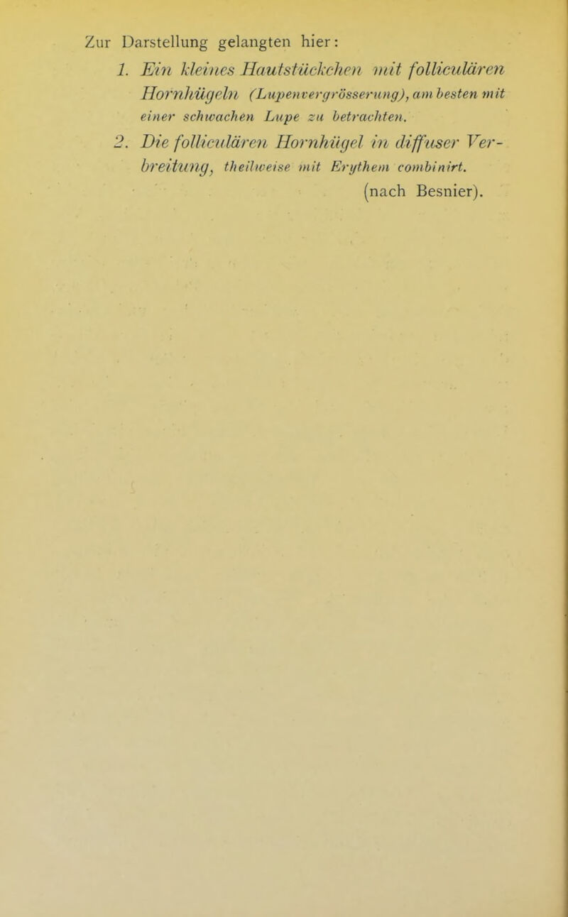 Zur Darstellung gelangten hier: 1. Ein kleines Hautsiückchen mit folliculäjrji Hornllügeln (Lupenvergrösserung), am besten mit einer schwachen Lupe zu betrachten. 2. Die foUiculären Hornhügel in diffuser Ver- breitnny, theiJweise mit Erythem combinirt. (nach Besnier).