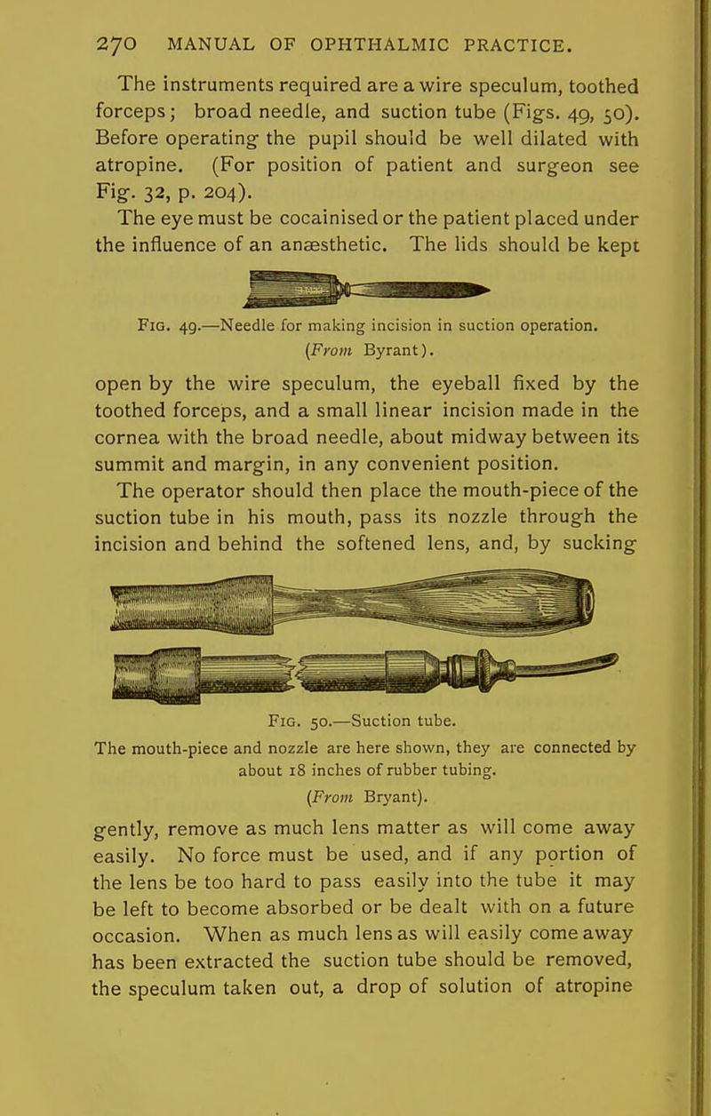The instruments required are a wire speculum, toothed forceps; broad needle, and suction tube (Figs. 49, 50). Before operating- the pupil should be well dilated with atropine. (For position of patient and surgeon see Fig. 32, p. 204). The eye must be cocainised or the patient placed under the influence of an anaesthetic. The lids should be kept Fig. 49.—Needle for making incision in suction operation. (From Byrant). open by the wire speculum, the eyeball fixed by the toothed forceps, and a small linear incision made in the cornea with the broad needle, about midway between its summit and margin, in any convenient position. The operator should then place the mouth-piece of the suction tube in his mouth, pass its nozzle through the incision and behind the softened lens, and, by sucking Fig. 50.—Suction tube. The mouth-piece and nozzle are here shown, they are connected by about 18 inches of rubber tubing. {From Bryant). gently, remove as much lens matter as will come away easily. No force must be used, and if any portion of the lens be too hard to pass easily into the tube it may be left to become absorbed or be dealt with on a future occasion. When as much lens as will easily come away has been extracted the suction tube should be removed, the speculum taken out, a drop of solution of atropine