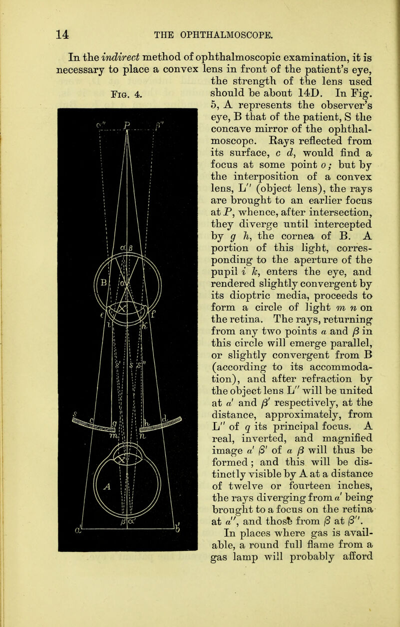 Tig. 4. In tlie indirect method of ophthalmoscopic examination, it is necessary to place a convex lens in front of the patient's eye, the strength of the lens used should be about 14D. In Fig. 5, A represents the observer's eye, B that of the patient, S the concave mirror of the ophthal- moscope. Rays reflected from its surface, c tZ, would find a focus at some point o; but by the interposition of a convex lens, L (object lens), the rays are brought to an earlier focus atP, whence, after intersection, they diverge until intercepted by g h, the cornea of B. A portion of this light, corres- ponding to the aperture of the pupil i k, enters the eye, and rendered slightly convergent by its dioptric media, proceeds to form a circle of light m n on the retina. The rays, returning from any two points a and y3 in this circle will emerge parallel, or slightly convergent from B (according to its accommoda- tion), and after refraction by the object lens L will be united at a and yS' respectively, at the distance, approximately, from L of q its principal focus. A real, inverted, and magnified image a (S' oi a will thus be formed ; and this will be dis- tinctly visible by A at a distance of twelve or fourteen inches, the rays diverging from a being brought to a focus on the retina at a, and thos^ from /S at In places where gas is avail- able, a round full flame from a gas lamp will probably afford
