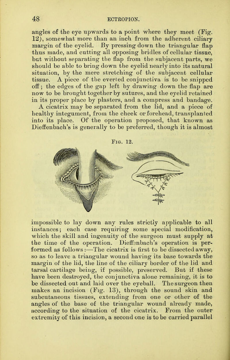 angles of the eye upwards to a point where they meet (Fig. 12), somewhat more than an inch from the adherent ciliary margin of the eyelid. By pressing down the triangular flap thus made, and cutting all opposing bridles of cellular tissue, bat without separating the flap from the subjacent parts, we should be able to bring down the eyelid nearly into its natural situation, by the mere stretching of the subjacent cellular tissue. A piece of the everted conjunctiva is to be snipped off; the edges of the gap left by drawing down the flap are now to be brought together by sutures, and the eyelid retained in its proper place by plasters, and a compress and bandage. A cicatrix may be separated from the lid, and a piece of healthy integument, from the cheek or forehead, transplanted into its place. Of the operation proposed, that known as Dieffenbach's is generally to be preferred, though it is almost Fig. 12. impossible to lay down any rules strictly applicable to all instances; each case requiring some special modification, which the skill and ingenuity of the surgeon must supply at the time of the operation. Dieflbnbach's operation is per- formed as follows :—The cicatrix is first to be dissected away, so as to leave a triangular wound having its base towards the margin of the lid, the line of the ciliary border of the lid and tarsal cartilage being, if possible, preserved. But if these have been destroyed, the conjunctiva alone remaining, it is to be dissected out and laid over the eyeball. The surgeon then makes an incision (Fig. 13), through the sound skin and subcutaneous tissues, extending from one or other of the angles of the base of the triangular wound already made, according to the situation of the cicatrix. From the outer extremity of this incision, a second one is to be carried parallel
