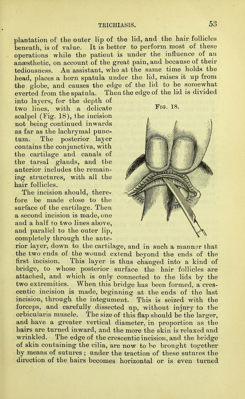 plantation of the outer lip of the lid, and the hair follicles beneath, is of value. It is better to perform most of these operations while the patient is under the influence of an anaesthetic, on account of the great pain, and because of their tediousness. An assistant, who at the same time holds the head, places a horn spatula under the lid, raises it up from the globe, and causes the edge of the lid to be somewhat everted from the spatula. Then the edge of the lid is divided into layers, for the depth of two lines, with a delicate scalpel (Fig. 18), ihe incision not being continued inwards as far as the lachrymal punc- tum. The posterior layer contains the conjunctiva, with the cartilage and canals of the tarsal glands, and the anterior includes the remain- ing structures, with all the hair follicles. The incision should, there- foi-e be made close to the surface of the cartilage. Then a second incision is made, one and a half to two lines above, and parallel to the outer lip, completely through the ante- rior layer, down to the cartilage, and in such a manner that the two ends of the wound extend beyond the ends of the first incision. This layer is thus changed into a kind of bridge, to whose posterior surface the hair follicles are attached, and which is only connected to the lids by the two extremities. When this bridge has been formed, a cres- centic incision is made, beginning at the ends of the last incision, through the integument. This is seized with the forceps, and carefully dissected up, without injury to the orbicularis muscle, the size of this flap should be the larger, and have a greater vertical diameter, in proportion as the hairs are turned inward, and the more the skin is relaxed and wrinkled. The edge of the crescentic incision, and the bridge of skin containing the cilia, are now to be brought together by means of sutures ; under the traction of these sutures the direction of the hairs becomes horizontal or is even turned Fia. 18.