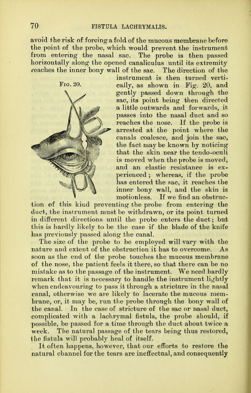 20. avoid the risk of forcing a fold of the nrncous membrane before the point of the probe, which would prevent the instrument from entering the nasal sac. The probe is then passed horizontally along the opened canaliculus until its extremity reaches the inner bony vrall of the sac. The direction of the instrument is then turned verti- cally, as shown in Fig. 20, and gently passed down through the saCy its point being then directed a little outwards and forwards, it passes into the nasal duct and so reaches the nose. If the probe is arrested at fche point where the canals coalesce, and join the sac, the fact may be known by noticing that the skin near the tendo-oculi is moved when the probe is moved, and an elastic resistance is ex- perienced ; whereas, if the probe has entered the sac, it reaches the inner bony wall, and the skin is motionless. If we find an obstruc- tion of this kind preventing the probe from entering the duct, the instrument must be withdrawn, or its point turned in different directions until the probe enters the duct; but this is hardly likely to be the case iF the blade of the knife has previously passed along the canal. The size of the probe to be employed will vary with the nature and extent of the obstruction it has to overcome. As soon as the end of the probe touches the mucous membrane of the nose, the patient feels it there, so that there can be no mistake as to the passag-e of the instrument. We need hardly remark that it is necessary to handle the instrument lightly when endeavouring to pass it through a stricture in the nasal canal, otherwise we are likely to lacerate the mucous mem- brane, or, it may be, run the probe through the bony wall of the canal. In the case of stricture of the sac or nasal duct, complicated with a lachrymal fistula, the probe should, if possible, be passed for a time through the duct about twice a week. The natural passage of the tears being thus restored, the fistula will probably heal of itself. It often happens, however, that our efforts to restore the natural channel for the tears are ineffectual, and consequently