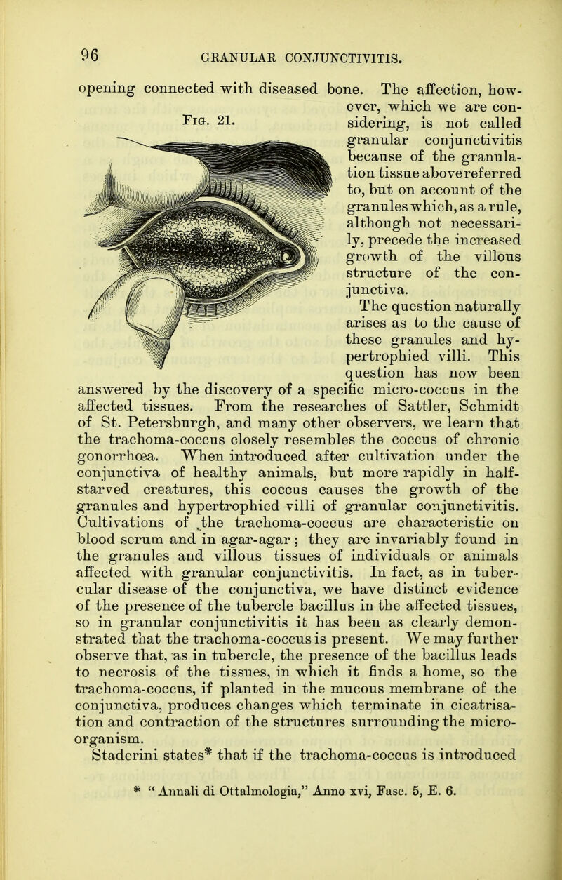 opening connected with diseased bone. The affection, how- ever, which we are con- sidering, is not called granular conjunctivitis because of the granula- tion tissue above referred to, but on account of the granules which, as a rule, although not necessari- ly, precede the increased growth of the villous structure of the con- junctiva. The question naturally arises as to the cause of these granules and hy- pertrophied villi. This question has now been answered by the discovery of a specific micro-coccus in the affected tissues. From the researches of Sattler, Schmidt of St. Petersburgh, and many other observers, we learn that the trachoma-coccus closely resembles the coccus of chronic gonorrhoea. When introduced after cultivation under the conjunctiva of healthy animals, but more rapidly in half- starved creatures, this coccus causes the growth of the granules and hypertrophied villi of granular conjunctivitis. Cultivations of ^the trachoma-coccus are characteristic on blood serum and in agar-agar ; they are invariably found in the granules and villous tissues of individuals or animals affected with granular conjunctivitis. In fact, as in tuber- cular disease of the conjunctiva, we have distinct evidence of the presence of the tubercle bacillus in the affected tissues, so in granular conjunctivitis it has been as clearly demon- strated that the trachoma-coccus is present. We may further observe that, as in tubercle, the presence of the bacillus leads to necrosis of the tissues, in which it finds a home, so the trachoma-coccus, if planted in the mucous membrane of the conjunctiva, produces changes which terminate in cicatrisa- tion and contraction of the structures surrounding the micro- organism. Staderini states* that if the trachoma-coccus is introduced * '* Annali di Ottalmologia, Anno xvi, Fasc. 5, E. 6.