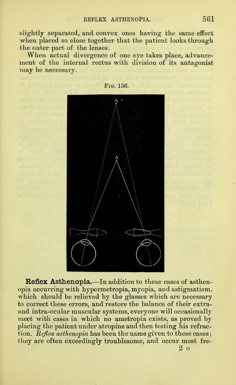 slightly separated, and convex ones having the same effect when placed so close together that the patient looks through the outer part of the lenses. When actual divergence of one eye takes place, advance- ment of the internal rectus with division of its antagonist may be necessary. Fia. 156. ■■• -■. - . ..: '■; ^, ; . ■ A ll ■.J Reflex Asthenopia.—In addition to these cases of asthen- opia occurring with hypermetropia, myopia, and astigmatism, which should be relieved by the glasses which are necessary to correct these errors, and restore the balance of their extra- and intra-ocular muscular systems, everyone will occasionally meet with cases in which no ametropia exists, as proved by placing the patient under atropine and then testing his refrac- tion. 'Reflex astlienopia has been th e name given to these cases; they are often exceedingly troublesome, and occur most fre- 2 0