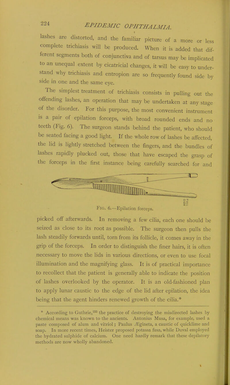 lashes are distorted, and the familiar picture of a more or less complete trichiasis will be produced. When it is added that dif- ferent segments both of conjunctiva and of tarsus may be implicated to an unequal extent by cicatricial changes, it will be easy to under- stand why trichiasis and entropion are so frequently found side by side in one and the same eye. The simplest treatment of trichiasis consists in pulling out the offending lashes, an operation that may be undertaken at any stage of the disorder. For this purpose, the most convenient instrument is a pair of epilation forceps, with broad rounded ends and no teeth (Fig. 6). The surgeon stands behind the patient, who should be seated facing a good light. If the whole row of lashes be affected, the lid is lightly stretched between the fingers, and the bundles of lashes rapidly plucked out, those that have escaped the grasp of the forceps in the first instance being carefully searched for and Fig. 6.—Epilation forceps. picked off afterwards. In removing a few cilia, each one should be seized as close to its root as possible. The surgeon then pulls the lash steadily forwards until, torn from its follicle, it comes away in the grip of the forceps. In order to distinguish the finer hairs, it is often necessary to move the lids in various directions, or even to use focal illumination and the magnifying glass. It is of practical importance to recollect that the patient is generally able to indicate the position of lashes overlooked by the operator. It is an old-fashioned plan to apply lunar caustic to the edge of the lid after epilation, the idea being that the agent hinders renewed growth of the cilia.* * According to Guthrie,-^ the practice of destroying the misdirected lashes by chemical means was known to the ancients. Antonius Musa, for example, used a paste composed of alum and vitriol; Paulus ^Egineta, a caustic of quicklime and soap. In more recent times, Heister proposed potassa fusa, while Duval employed the hydrated sulphide of calcium. One need hardly remark that these depilator)- methods are now wholly abandoned.