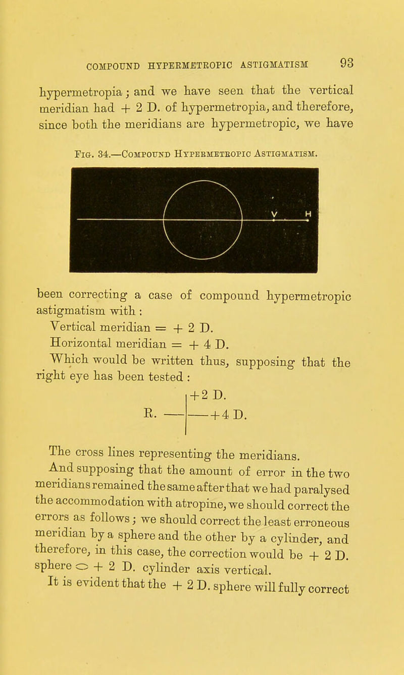 typermetropia; and we have seen that the vertical meridian had + 2 D. of hypermetropiaj and therefore, since both the meridians are hypermetropic, we have 'Em. 34.—Compound Htpeemeteopio Astigmatism. been correcting a case of compound hypermetropic astigmatism with : Vertical meridian = + 2 D. Horizontal meridian = + 4 D. Which would be written thus, supposing that the right eye has been tested : + 2 D. E. -4D. The cross lines representing the meridians. And supposing that the amount of error in the two meridians remained the same after that we had paralysed the accommodation with atropine, we should correct the errors as follows; we should correct the least erroneous meridian by a sphere and the other by a cylinder, and therefore, in this case, the correction would be + 2 D. sphere o + 2 D. cylinder axis vertical. It is evident that the + 2 D. sphere will fully correct