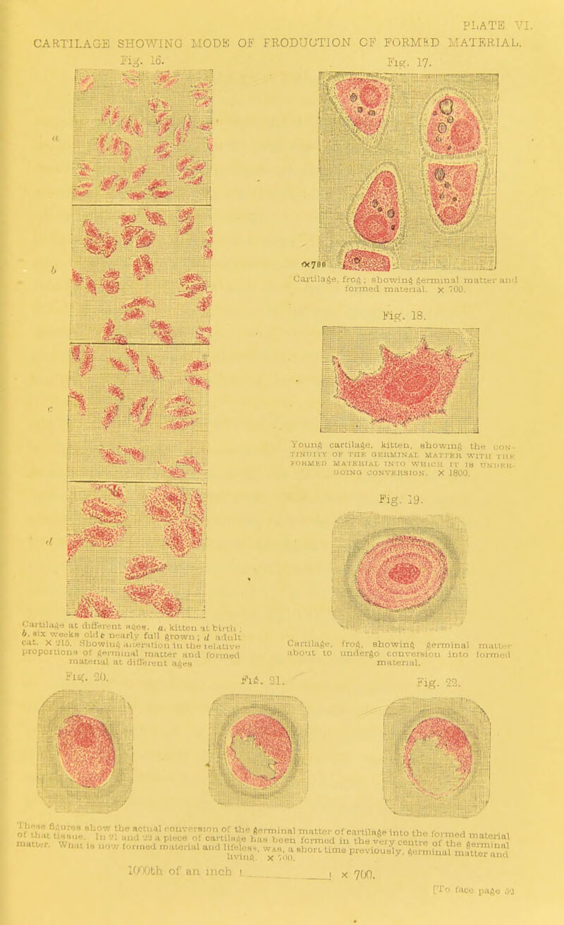 CARTILAGE SHOWING MODB) OF FRODUUTION OF FORMKD MATERIAL. « -sq I'lSt- 17- =1 0 J' =0 : 1 Cartilage, fro^ ; sbowin^ ftermmal matter uihI formed material. X '00. Young cartilage, kitten, aliowmg the uos'- TJNriHY OF THE OEllMINAX MATJ'ER WI'I-I! 'IILI.' FOHMlLl) MAIKRIAI INIO WHIUU IT TS UNDKIi- UOISO OONVEHSIO.S-. X 1800. ii lilii^rt !it ditlr-] - n:, a. kilteo birth : SIX wc=ka ol.lc u.,.iriv full grown; li a'Uilt It. X alO. flbowiu;; .utei-Htion iu tbe teUtlvo Cartilage, roportiona of iSemiuml mntter and rontiBd about to mateiiul a. ,,,11 ngea Fis;. 20. ji-i^. ni fi-oi^. Showing germinal mattt'i- undergo convei-siou into lormed inaterial. .Uo,v the acu;.il couvt-rsinn of th« germhrnl matter of cartilage into the foi-med malmH^i I..'.'. „nd-JJ a pii-oo ot cartiafte baa been formod iu the very centre of S,e4M?i,?v^?i ... u,.w Ior,nod rpau=r>al and lifelea^,. w^vh, a ahor. lime previoua^y erminal mltt^Zi I'/Oth of an inch 1 . , x Jifl.
