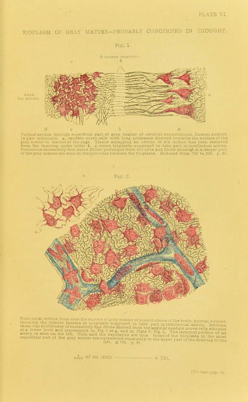 PLATE VI. BIOl^LASM OF GRAY MATTER-PROBABLY CONCERNED IN THOUGHT. Yip;. 1. 6 INOUE.S RKMOVFI). 6 NEAR PI A UAIEH, Vci-Lical section through superficial part of gray matter of cerebral couvolutious, human subject. In part scheinaiic. a. caud»te nerve celly with long processea directed towards the surface of Uie $ray matter to the left of the page. Tissue occupying an extent of sis inches has been removed, from the diawing under letter 6. c, nerve bioplasts,-supposed to take part in intellectual action. Numerous excessively fine nerve fibres prolonged from the cells and fibres aituat.^ at a deeper p;i r t of the gray mactei'- are seen in the int*^i-val3 between the bioplasLs, deduced, from 700 to .350, p. 01. hliowmg the minute masses of bioplasm supposed co take narC in iutfllf^ntual nrtin., „' ]ett. X '00, p, 6]. of an inch X 700. [To face page- lij