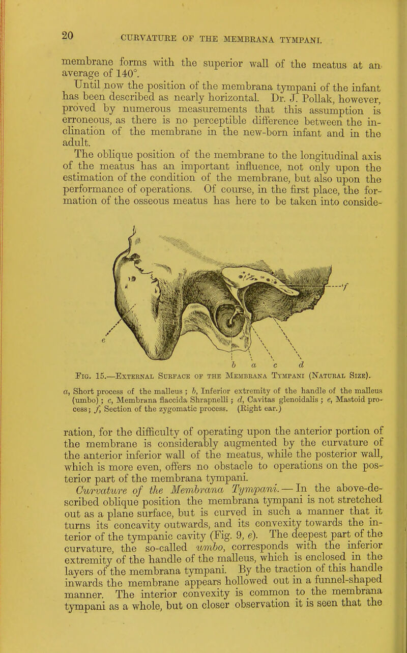 membrane forms with the superior wall of the meatus at an average of 140°. Until now the position of the membrana tympani of the infant has been described as nearly horizontal. Dr. J. Pollak, however, proved by numerous measurements that this assumption is erroneous, as there is no perceptible difference between the in- clination of the membrane in the new-born infant and in the adult. The obHque position of the membrane to the longitudinal axis of the meatus has an important influence, not only upon the estimation of the condition of the membrane, but also upon the performance of operations. Of course, in the first place, the for- mation of the osseous meatus has here to be taken into conside- TiG. 15.—External Sukface of the Membbana Tympani (Natubal Size). a, Short process of the malleus ; h. Inferior extremity of the handle of the malleus (umbo); c, Membrana flaccida Shrapnelli; d, Cavitas glenoidalis ; e, Mastoid pro- cess; /, Section of the zygomatic process. (Right ear.) ration, for the difficulty of operating upon the anterior portion of the membrane is considerably augmented by the curvature of the anterior inferior wall of the meatus, while the posterior wall, which is more even, offers no obstacle to operations on the pos- terior part of the membrana tympani. Curvature of the Membrana Tympani. — In_ the above-de- scribed obHque position the membrana tympani is not stretched out as a plane surface, but is curved in such a manner that_ it turns its concavitv outwards, and its convexity towards the m- terior of the tympanic cavity (Fig. 9, e). The deepest part of the curvature, the so-called umbo, corresponds with the mferior extremity of the handle of the malleus, which is enclosed m the layers of the membrana tympani. By the traction of this handle inwards the membrane appears hollowed out m a funnel-shaped manner. The interior convexity is common to the membrana tympani as a whole, but on closer observation it is seen that the