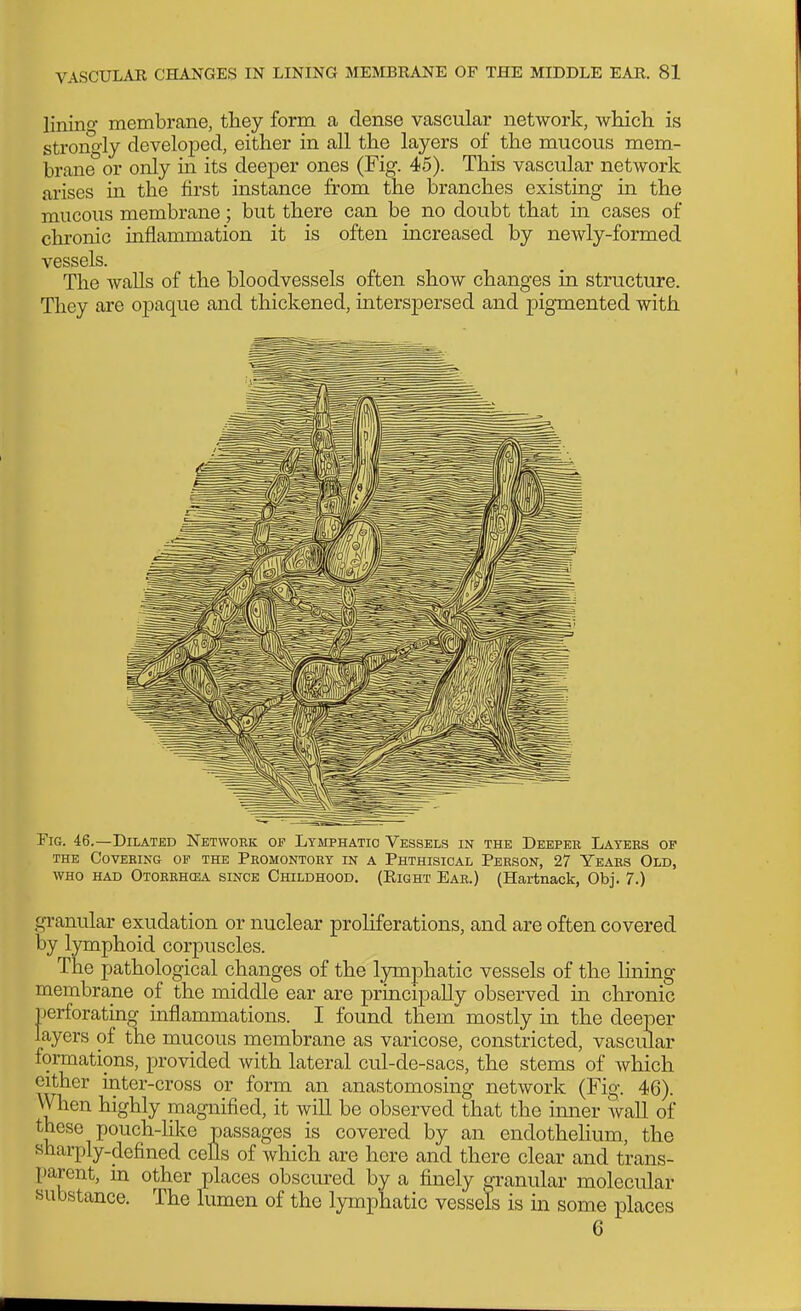 linino- membrane, tbey form a dense vascular network, which is strong-ly developed, either in all the layers of the mucous mem- brane or only in its deeper ones (Fig. 45). This vascular network arises in the first instance from the branches existing in the mucous membrane; but there can be no doubt that in cases of chronic inflammation it is often increased by newly-formed vessels. The AvaUs of the bloodvessels often show changes in structure. They are ojDaque and thickened, interspersed and pigmented with Fig. 46.—Dilated Network of Lymphatic Vessels in the Deeper Layers op THE Covering of the Promontory in a Phthisical Person, 27 Years Old, WHO had Otorrhcea since Childhood. (Right Ear.) (Hartnack, Obj. 7.) gi-anular exudation or nuclear proliferations, and are often covered by lymphoid corpuscles. The pathological changes of the lymphatic vessels of the lining membrane of the middle ear are principally observed in chronic perforating inflammations. I found them mostly m the deeper layers of the mucous membrane as varicose, constricted, vascular formations, provided with lateral cul-de-sacs, the stems of which either inter-cross or form an anastomosing network (Fig. 46). When highly magnified, it will be observed that the imier wall of these pouch-Hke passages is covered by an endothelium, the sharply-defined cells of which are here and there clear and trans- parent, m other places obscured by a finely granular molecular substance. The lumen of the lymphatic vessels is in some places 6