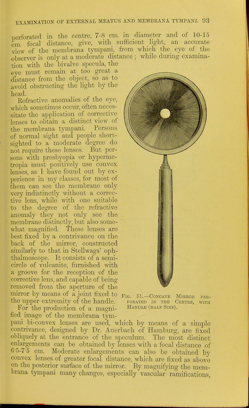 perforated in the centre, 7-8 cm. in diameter and of 10-15 cm. focal distance, give, with sufficient light, an accurate view of the membrana tympani, from which the_ eye of the observer is only at a moderate distance ; while durmg examina- tion with the bivalve specula, the eye must remain at too gi-eat a distance from the object, so as to avoid obstructing the light by the head. Refractive anomahes of the eye, which sometimes occm, often neces- sitate the apphcation of corrective lenses to obtain a distinct view of the membrana tympani. Persons of normal sight and people short- sighted to a moderate degree do not requhe these lenses. But per- sons with presbyopia or hyperme- tropia must positively use convex lenses, as I have found out by ex- perience in my classes, for most of them can see the membrane only very indistinctly without a correc- tive lens, while with one suitable to the degree of the refractive anomaly they not only see the membrane distinctly, but also some- what magnified. These lenses are best fixed by a contrivance on the back of the mirror, constructed similarly to that m Stellwags' oph- thalmoscope. It consists of a semi- circle of vulcanite, furnished with a groove for the reception of the corrective lens, and capable of being removed from the aperture of the mirror by means of a joint fixed to ^ig. 51.-Conoave Mirrok i>ek- the upper extremity of the handle. foeated in the Centee, with For the production of a magni- Handle (half Size). fied image of the membrana tym- pani _bi-convex lenses are used, which by means of a simple contrivance, designed by Dr. Auerbach of Hamburg, are fixed obliquely at the entrance of the speculum. The most distinct enlargements can be obtamed by lenses with a focal distance of 6-5-7'5 cm. Moderate enlargements can also be obtained by convex lenses of greater focal distance, which are fixed as above on the posterior surface of the mirror. By magnifying the mem- brana tympani many changes, especially vascular ramifications,