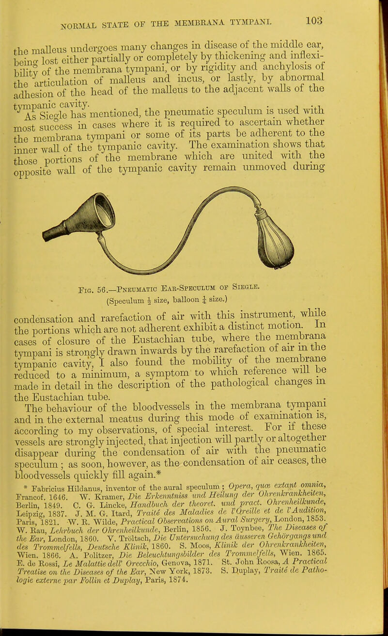 the maUeus undergoes many changes m disease oi the middle ear, Wo- lost cither partially or completely by thickening and mflexi- hiHtv of the membrana tympani, or by rigidity and anchylosis oj the articulation of malleus and mcus, or lastly, by abnormal adhesion of the head of the maUeus to the adjacent walls ot the *'^fslS>-l?has mentioned, the pneumatic speculum is used with most success in cases where it is requu-ed to ascertain whether the membrana tympani or some of its parts be adherent to the inner wall of the tympanic cavity. The examination shows that those portions of the membrane which are united with the opposite waU of the tympanic cavity remain unmoved durmg Tig. 56.—Pneumatic Eab-Spkoulum of Siegle. (Speculum 4 size, balloon | size.) condensation and rarefaction of air with this instrument, wh^e the portions which are not adherent exhibit a distmct motion In cases of closure of the Eustachian tube, where the membrana tympani is strongly drami inwards by the rarefaction ot an m tne tVmpanic cavity? I also found the mobihty of the membrane reduced to a mhiimum, a symptom to which reference wiU be made m detail m the description of the pathological changes m the Eustachian tube. The behaviour of the bloodvessels in the membrana tympani and m the external meatus during this mode of examm_^ion is, according to my observations, of special mterest. For it these vessels are strongly injected, that uijection will partly or altogether disappear durmg the condensation of an with the pneumatic speculum ; as soon, however, as the condensation of an ceases, the bloodvessels quickly fill again.* * Fabricius Hildanus, inventor of the aural speculum ; Opera, quoi extant omnia, Prancof. 1646. W. Kramer, Die Erkenntniss unci Heiluwj cler Ohrenkrankheiten, Berlin, 1849. C. G. Lincke, Hanclbuch der theoret. und pmet. Ohrenkeillzunde, Leipzig, 1837. J. M. G. Itard, Trail6 des Maladies de I'Oredle et de lAudilwn, Paris, 1821. W. R. Wilde, Practical Observations on Aural Surgenj, London, lUbd. W. Rau, Lckrhuch der Ohrenhdlkunde, Berlin, 1856. J. Toynbee, The Diseases of the Ear, London, 1860. V. Troltsch, Die Untersuchunr/ des ausseren Gehorgangs und des Trommel/ells, Deutsche Klinik, 1860. S. Moos, Klinik der Ohrenkrankheiten, Wien. 1866. A. Politzer, Die. Beleuchtungsbilder des Trommelfells, Wien. 1865. E. de Rossi, Le Malattie delV Orecchio, Genova, 1871. St. John Roosa, A Practical Treatise on the Diseases of the Ear, New York, 1873. S. D.uplay, Traite de Patho- logic eztcrne 2^ar Follin et Duplay, Paris, 1874.