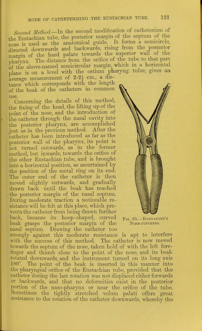 Second Method—In the second modification of catheterism of the Eustachian tube, the posterior margin of the septum of the nose is used as the anatomical guide. It forms a semicircle, directed doivnwards and backwards, rising from the posterior maro-in of the hard palate towards the superior wall of the pharynx The distance from the orifice of the tube to that part of the above-named semicircular margin, which m a horizontal plane is on a level with the ostium pharyng. tuboe, gives an average measurement of cm., a dis- tance^Avhich corresponds with the length of the beak of the catheters m common 11S6 Concerning the details of this method, the fixing of the head, the lifting up of the pomt of the nose, and the introduction of the catheter through the nasal cavity into the posterior pharynx, are accomplished just as in the previous method. After the catheter has been introduced as far as the posterior wall of the pharynx, its point is not turned outwards, as in the former method, but inwards, towards the orifice of the other Eustachian tube, and is brought into a horizontal position, as ascertained by the position of the metal ring on its end. The outer end of the catheter is then moved slightly outwards, and gradually drawn back until the beak has reached the posterior margin of the nasal septum. During moderate traction a noticeable re- sistance will be felt at this place, which pre- vents the catheter from being drawn further back, because its hoop-shaped, curved beak grasps the posterior margin of the nasal septum. Drawing the catheter too strongly against this moderate resistance is apt to interfere with the success of this method. The catheter is now moved towards the septum of the nose, taken hold of with the left fore- finger and thumb close to the point of the nose, and its beak rotated downwards, and the instrument turned on its long axis 180°. The point of the beak is inserted in this manner into the pharyngeal orifice of the Eustachian tube, provided that the catheter during the last rotation was not displaced either forwards or backwards, and that no deformities exist in the posterior portion of the naso-pharynx or near the orifice of the tube. Sometimes the tightly stretched velum palati offers great resistance to the rotation of the catheter downwards, whereby the Fig. 60.—Bonnafont's nose-pinchees.