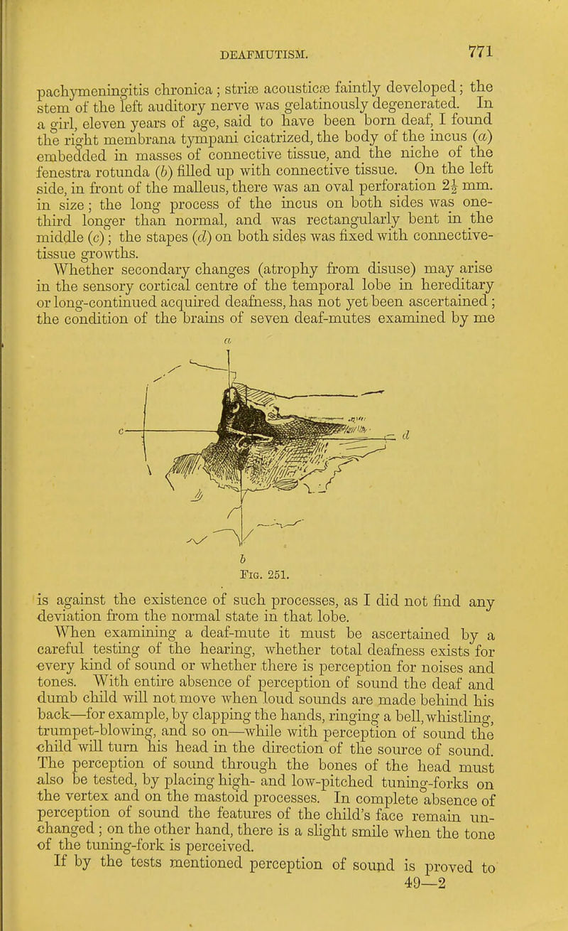 pachymeningitis chronica; strios acoustica3 faintly developed; the stem of the left auditory nerve was gelatinously degenerated. In a o-irl, eleven years of age, said to have been born_ deaf, I found the right membrana tympani cicatrized, the body of the incus (a) embedded in masses of connective tissue, and the niche of the fenestra rotunda (6) filled up with connective tissue. On the left side, in front of the malleus, there was an oval perforation 2|- mm. in size; the long process of the incus on both sides was one- third longer than normal, and was rectangularly bent in the middle (c); the stapes {d) on both sides was fixed with connective- tissue growths. Whether secondary changes (atrophy from disuse) may arise in the sensory cortical centre of the temporal lobe in hereditary or long-continued acquired deafness, has not yet been ascertained; the condition of the brains of seven deaf-mutes examined by me Tig. 251. is against the existence of such processes, as I did not find any deviation from the normal state in that lobe. When examining a deaf-mute it must be ascertained by a careful testing of the hearing, whether total deafness exists for every kind of sound or whether there is perception for noises and tones. With entire absence of perception of sound the deaf and dumb child wUl not move when loud somids are made behind his back—for example, by clapping the hands, ringing a bell, whistling, trumpet-blowing, and so on—while with perception of sound the child will turn his head in the direction of the source of sound. The perception of sound through the bones of the head must also be tested, by placing high- and low-pitched tuning-forks on the vertex and on the mastoid processes. In complete absence of perception of sound the features of the child's face remain un- changed ; on the other hand, there is a shght smile when the tone of the tuning-fork is perceived. If by the tests mentioned perception of sou^d is proved to 49—2