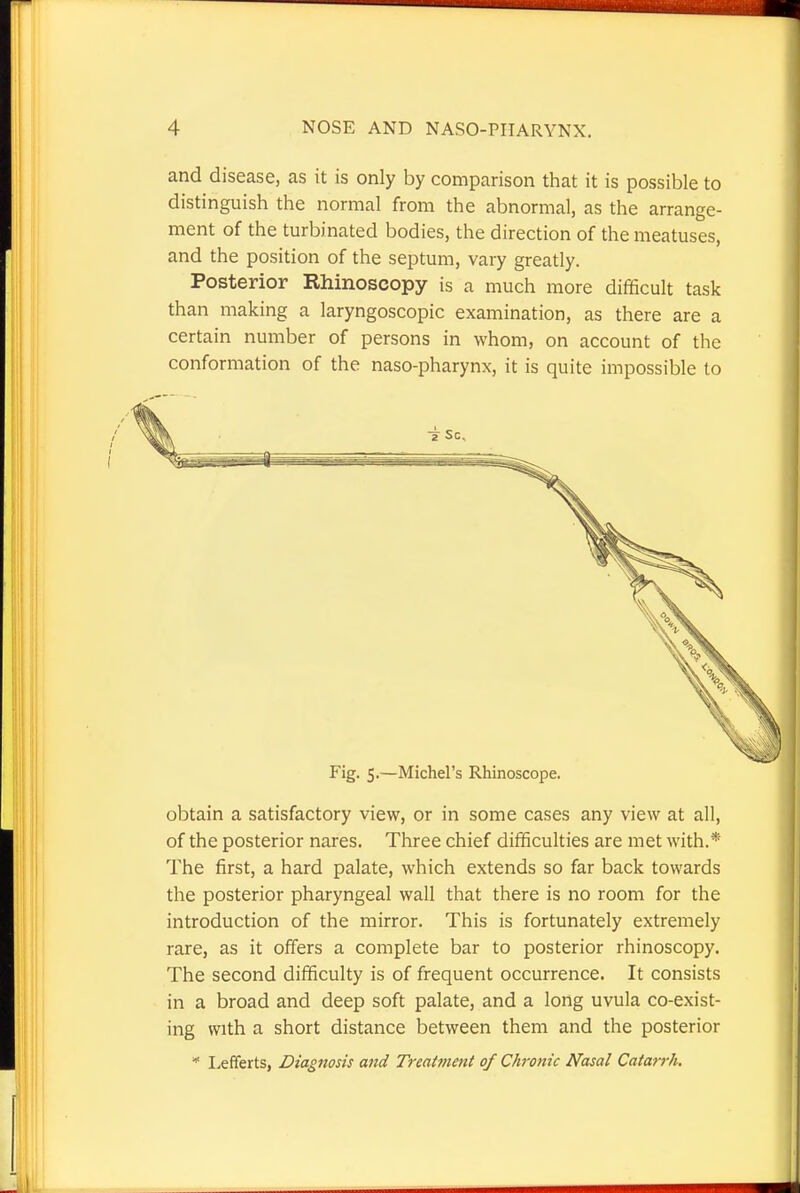and disease, as it is only by comparison that it is possible to distinguish the normal from the abnormal, as the arrange- ment of the turbinated bodies, the direction of the meatuses, and the position of the septum, vary greatly. Posterior Rhinoscopy is a much more difficult task than making a laryngoscopic examination, as there are a certain number of persons in whom, on account of the conformation of the naso-pharynx, it is quite impossible to Fig. 5.—Michel's Rhinoscope. obtain a satisfactory view, or in some cases any view at all, of the posterior nares. Three chief difficulties are met with.* The first, a hard palate, which extends so far back towards the posterior pharyngeal wall that there is no room for the introduction of the mirror. This is fortunately extremely rare, as it offers a complete bar to posterior rhinoscopy. The second difficulty is of frequent occurrence. It consists in a broad and deep soft palate, and a long uvula co-exist- ing with a short distance between them and the posterior * Lefferts, Diagnosis and Treatment of Chronic Nasal Catarrh.